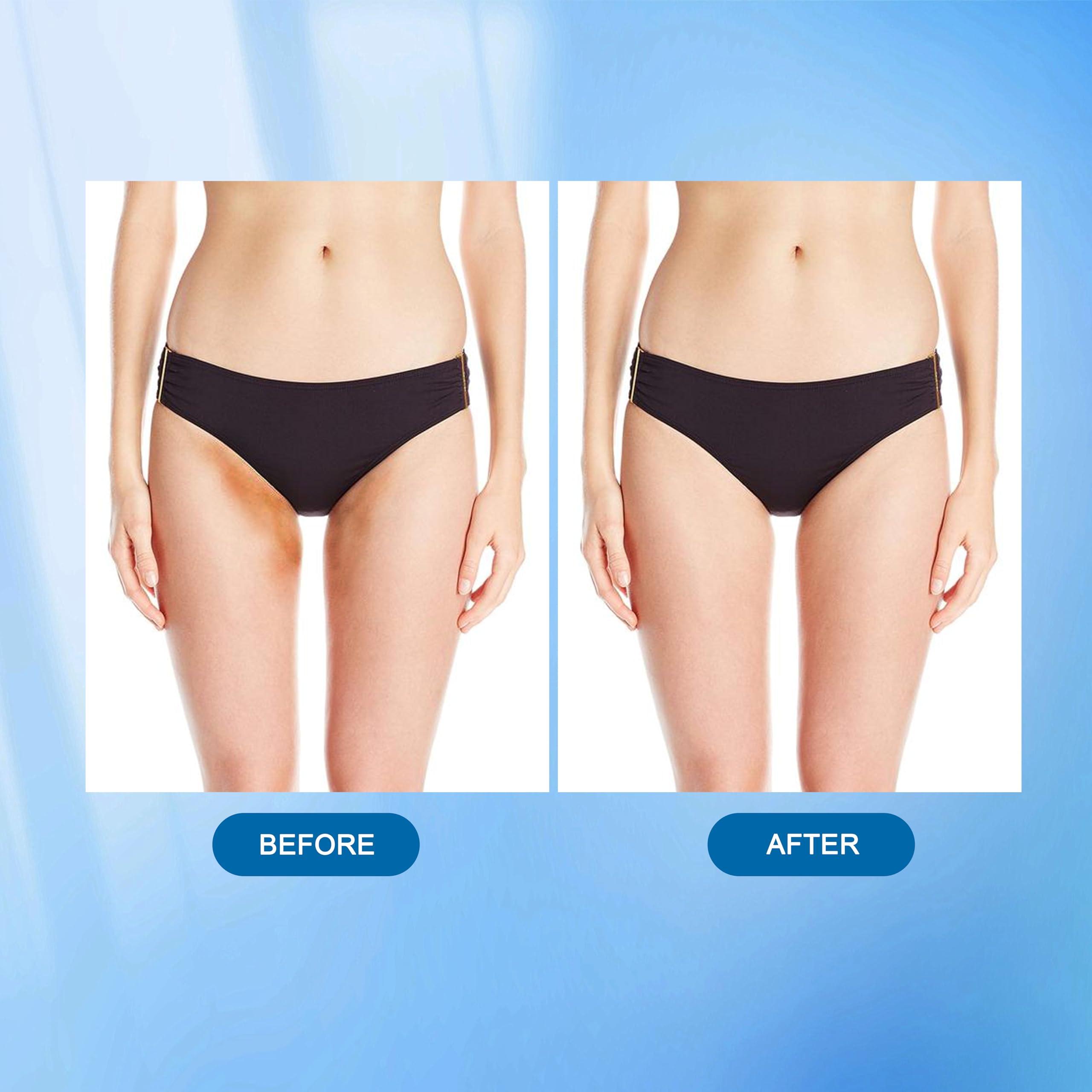 Nirraleza Skin Bleaching Cream for Body Intimate Areas, Skin Whitening Cream, Skin Lightening Cream, Dark Spot Remover for Private Parts, Underarms, Knees, Armpits, Elbows, Inner Thighs (1.7 Fl Oz) (1.7 Fl Oz)