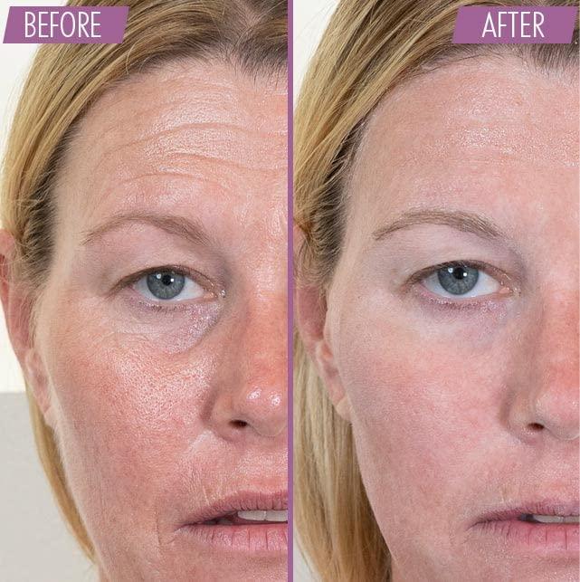 Athena 7 Minute Lift ATHENA 7 MINUTE LIFT - Instant Face Lift Cream - Results in 7 minutes - Eye, Neck, Face Tightening, Lifting & Firming Serum - Anti-Wrinkle Cream - ALL ORGANIC