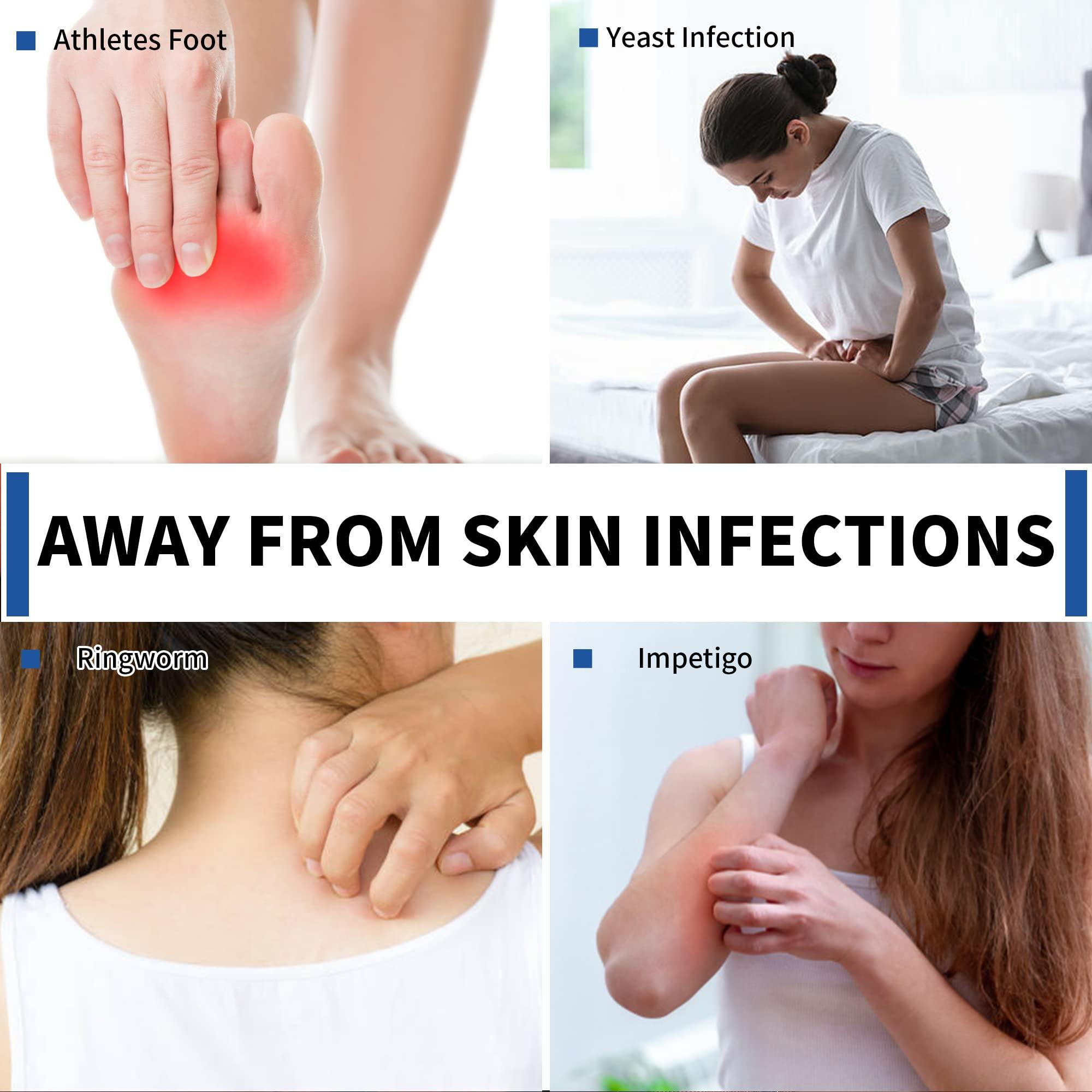 Battleskin Battleskin Antifungal Medicated Soap Bar, Tea Tree Oil Body Soap Bar, Athletes Foot Jock Itch Ringworm Yeast Infection Treatment With Natural Oil