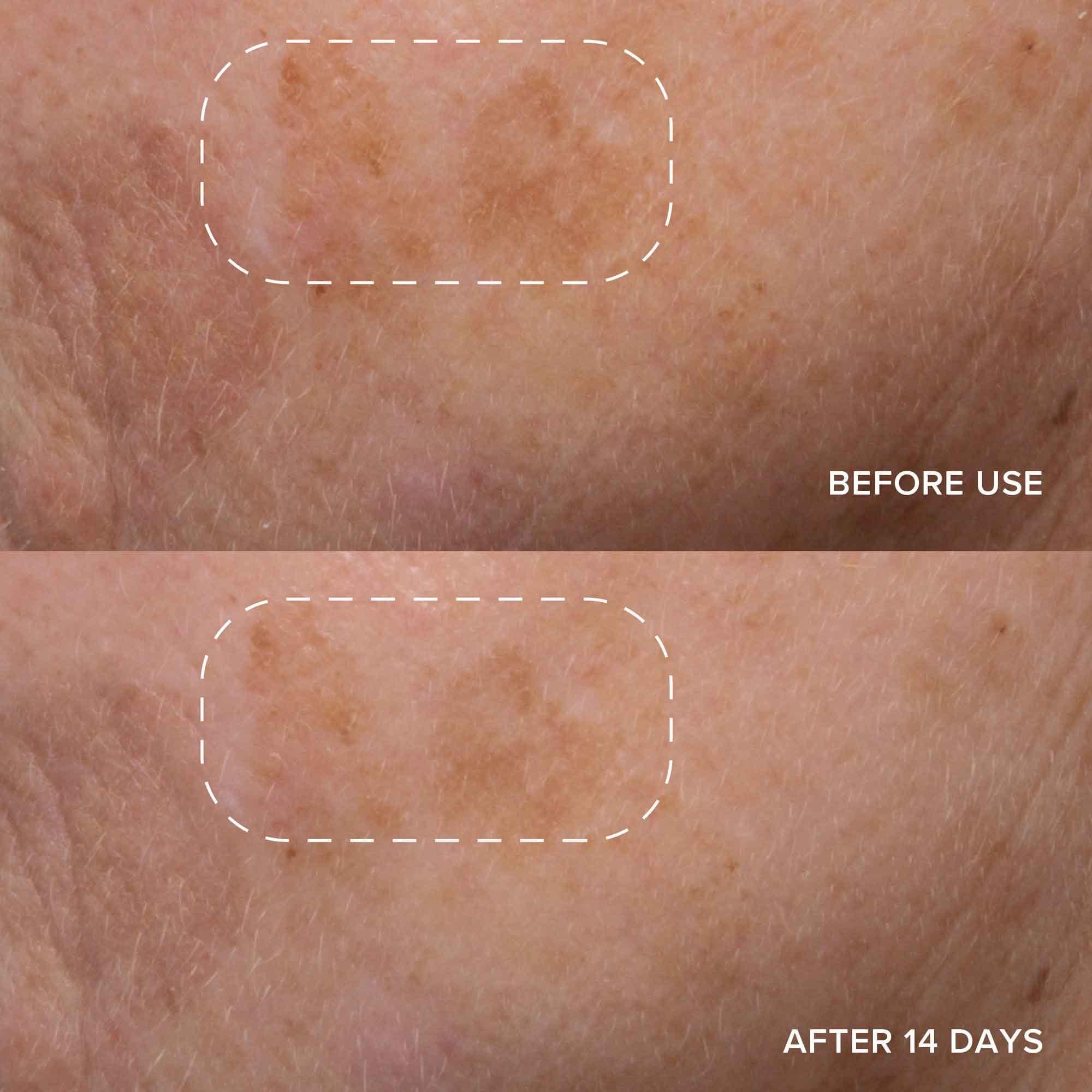 Alpyn Beauty Alpyn Vitamin C & Bearberry Instant Glow Serum | Delivers an Instant Glow While Fading the Look of Dark Spots | 1.7 oz / 50 ml