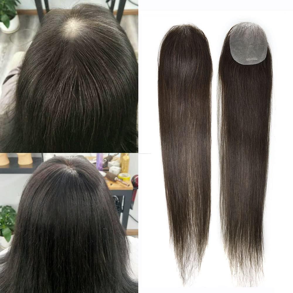 Lyrical Hair Bald Spot Hair Patch Toupee for Women Men Full Skin Base Human Hair Patch for Bald Spot Non-Surgical V-Looped Hair Replacement Black Brown Hairpiece 14\" #3 Dark Brown-100% density