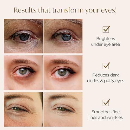 PLANTIFIQUE PLANTIFIQUE Gold Under Eye Patches for Puffy Eyes and Dark Circles 5 Pairs Under Eye Masks for Dark Circles and Puffiness Eye Gels with Collagen & Caffeine Eye Patches Gold Eye Mask Skincare