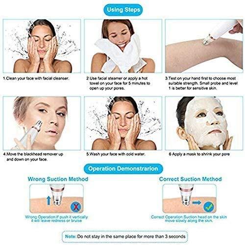 yigeren Qin Black Head Suctioner,Blackhead Remover Vacuum,Blackhead Remover Pore Vacuum - Electric Pore Cleaner, Blackhead Extractor Tool for Women and Men,USB Rechargeable LCD Display