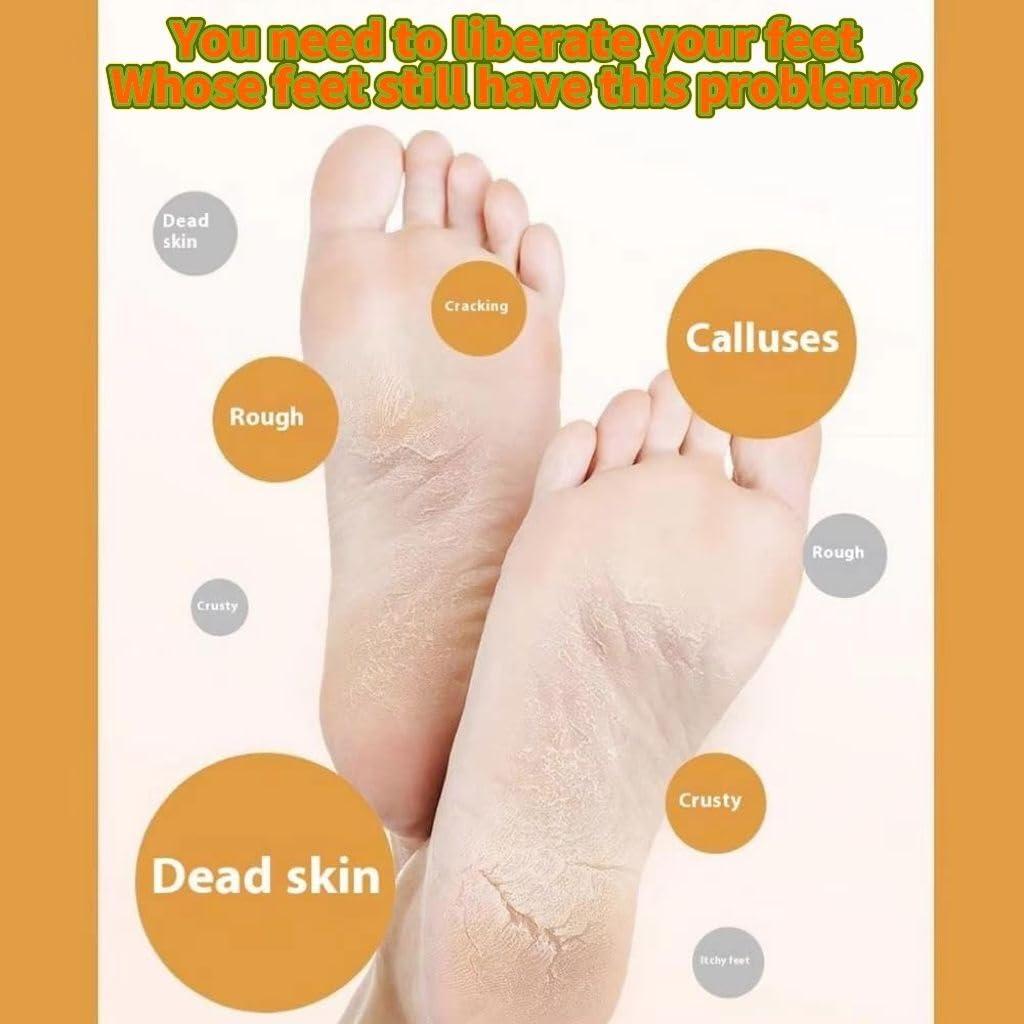 FENGKUI Electric Foot File,Foot Grinder,Electric Callus Remover for feet, Upgrade Digital Electric Foot Polisher,Electric Foot File Grinding Machine,Foot File Electric,for Heels, Arches, Soles(Gray)