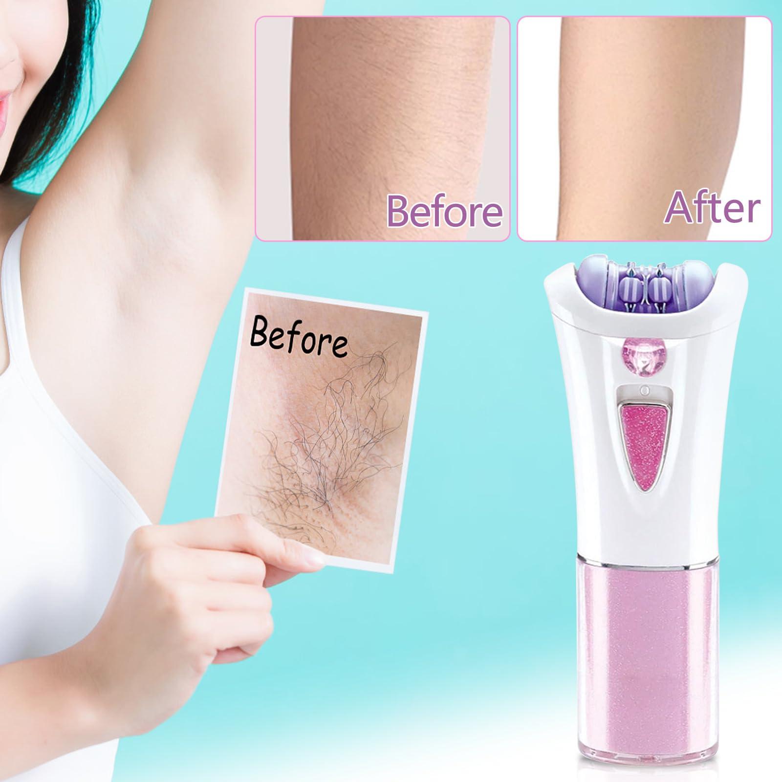 RaisingKoi Glabrousskin Epilator, Glabrousskin Hair Remover for Face, Glabrous Skin Epilator Skin Facial Hair Remover (1pc)