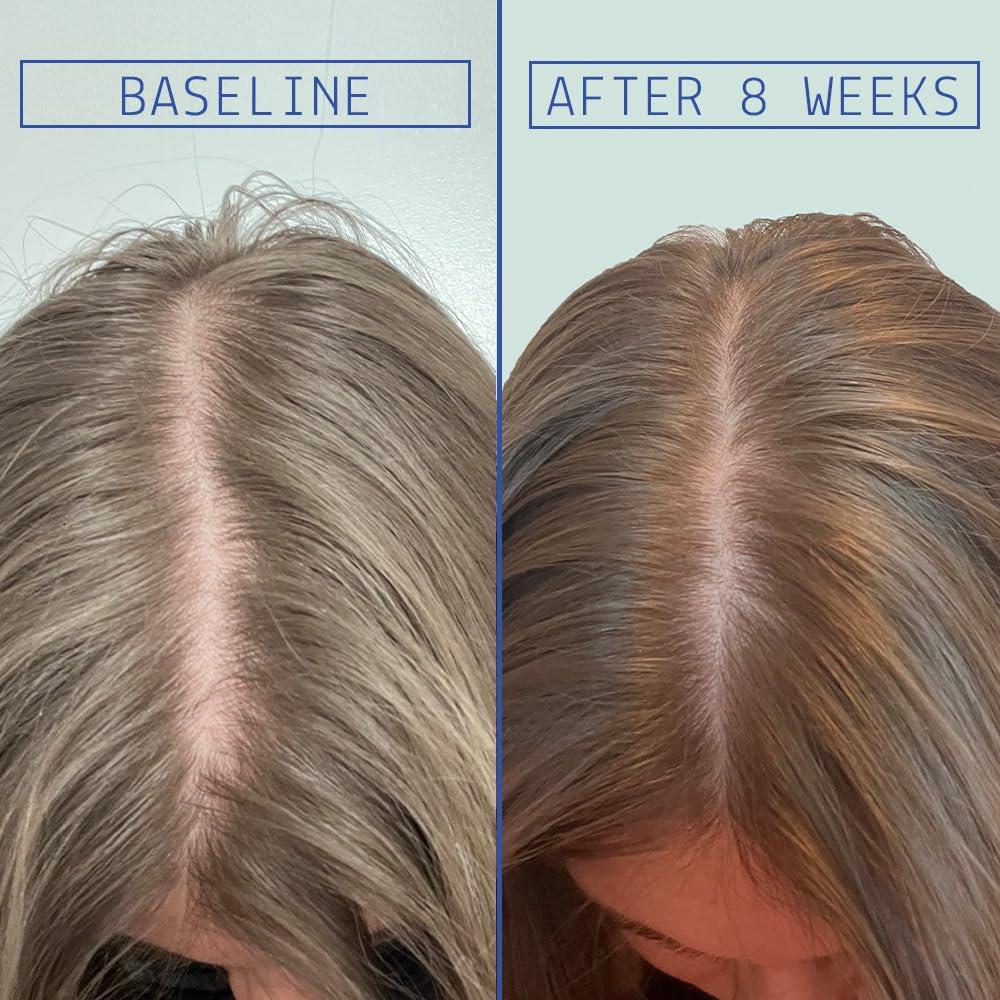 AAVRANI AAVRANI Hair Density Boosting Treatment - Ashwagandha, Vegan Collagen, And Turmeric Scalp Serum For Thicker, Fuller Hair - Vegan, Non-Greasy - 2 Fl Oz