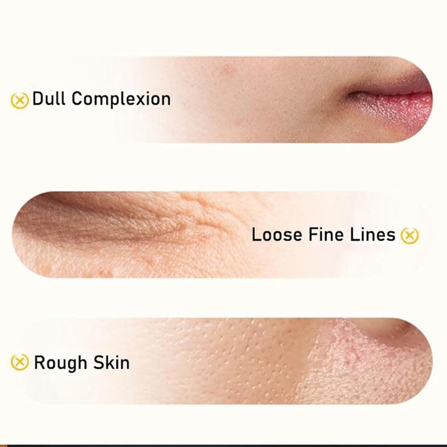 BOXBIT Removal Cream JapanesePolypeptide Cream For Facial,Change For Beautiful Skin Within 2 WeeksPolypeptide Cream For Facial,Educes Fine Lines Anti-Aging Anti-Wrinkle Cream ( Size : 4Count (Pack of 4) )