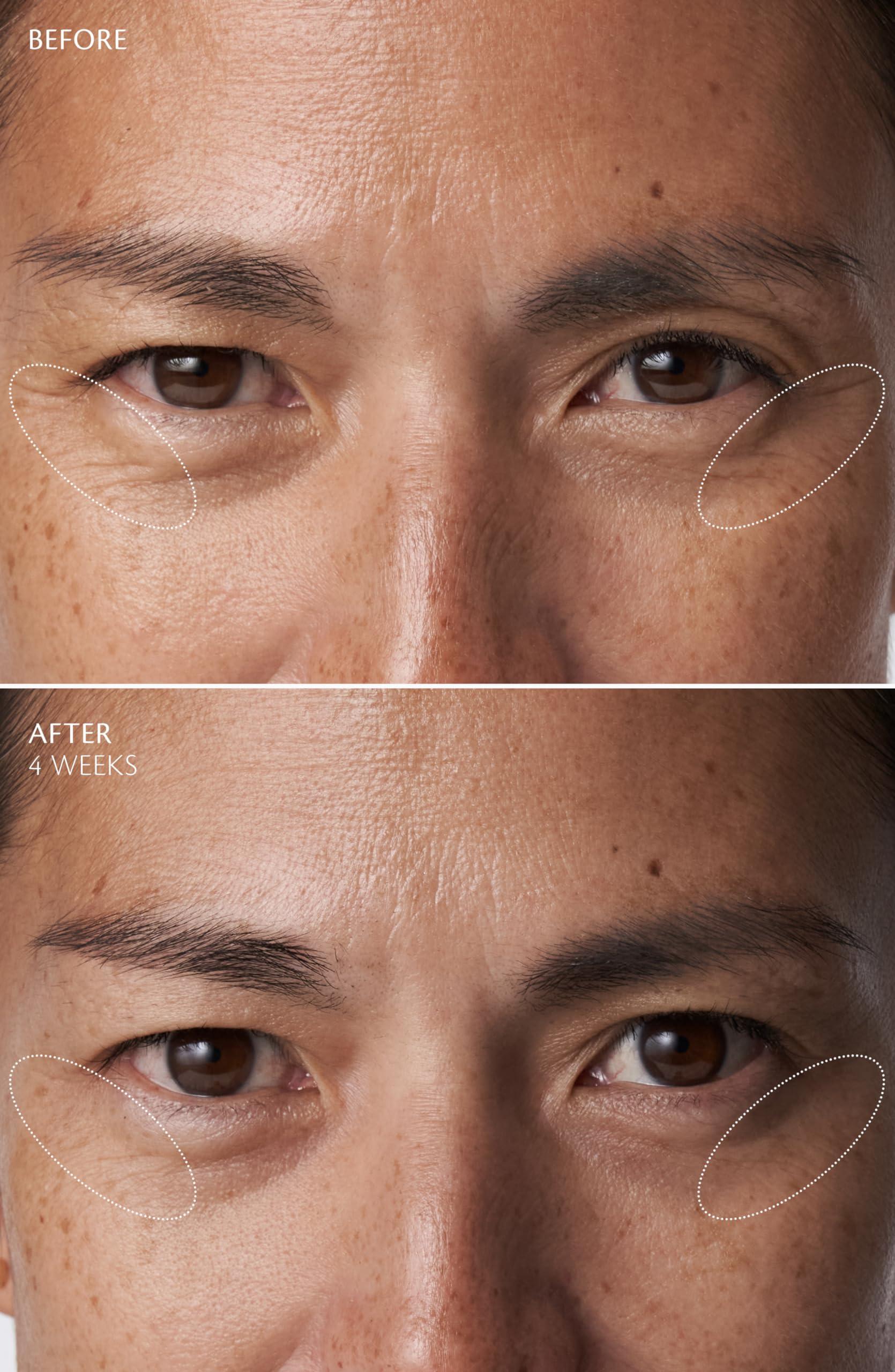 Cl de Peau Beaut Cl de Peau Beaut, Eye Contour Cream Supreme