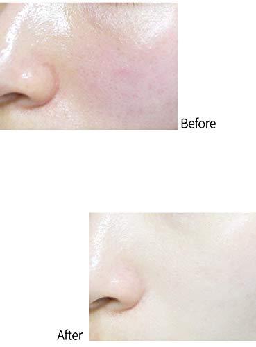 Aperire Clay Mask Be Frozen Pores Cooling Deep Clean, Sensitive Skin Acne Oily Blackheads 4.2 oz