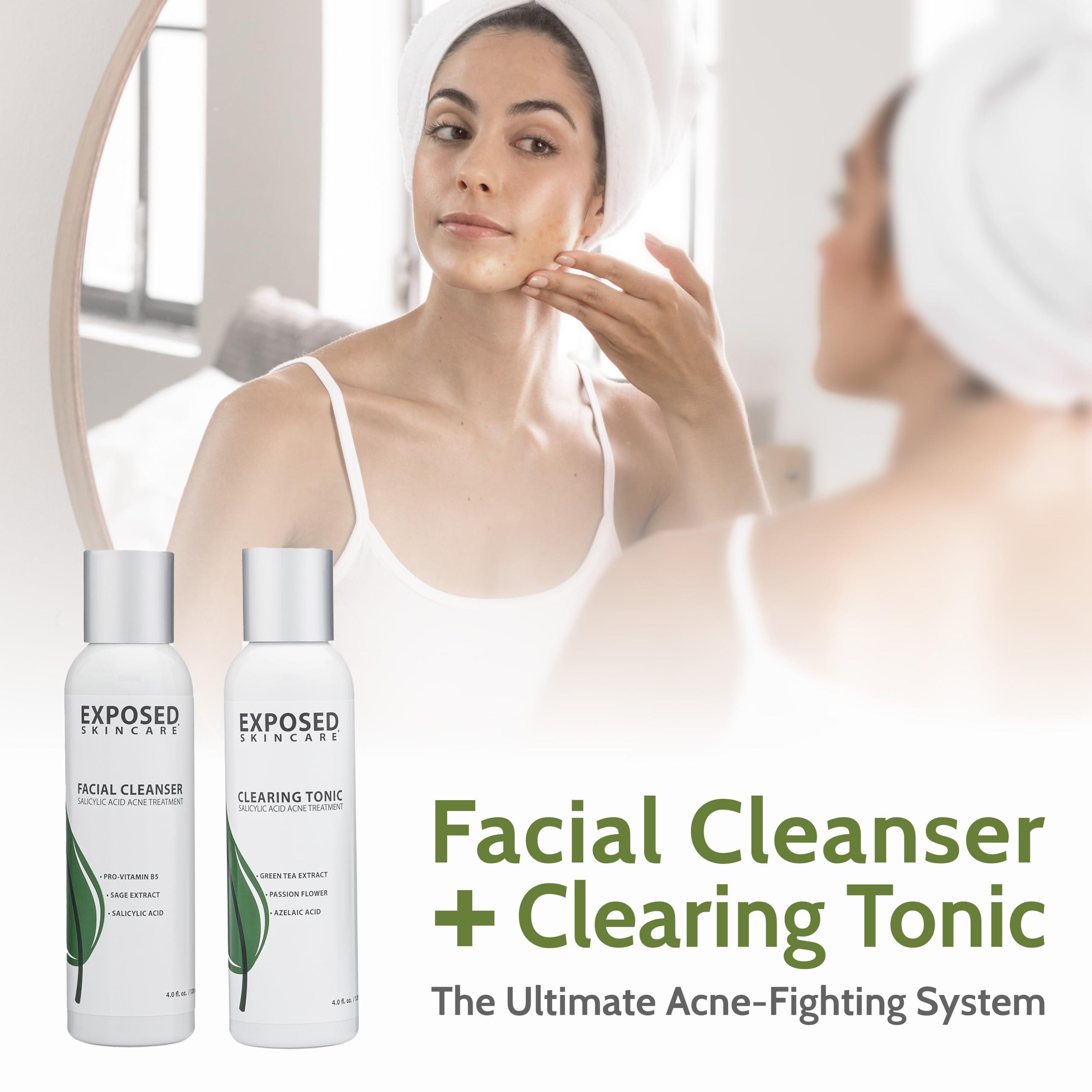 Exposed Skin Care Exposed Skin Care Basic Acne Treatment Kit - Includes Salicylic Acid Face Wash, Clearing Tonic, Acne Treatment Serum with Benzoyl Peroxide, Clear Pore Serum - Acne Set Solution for All Skin Types