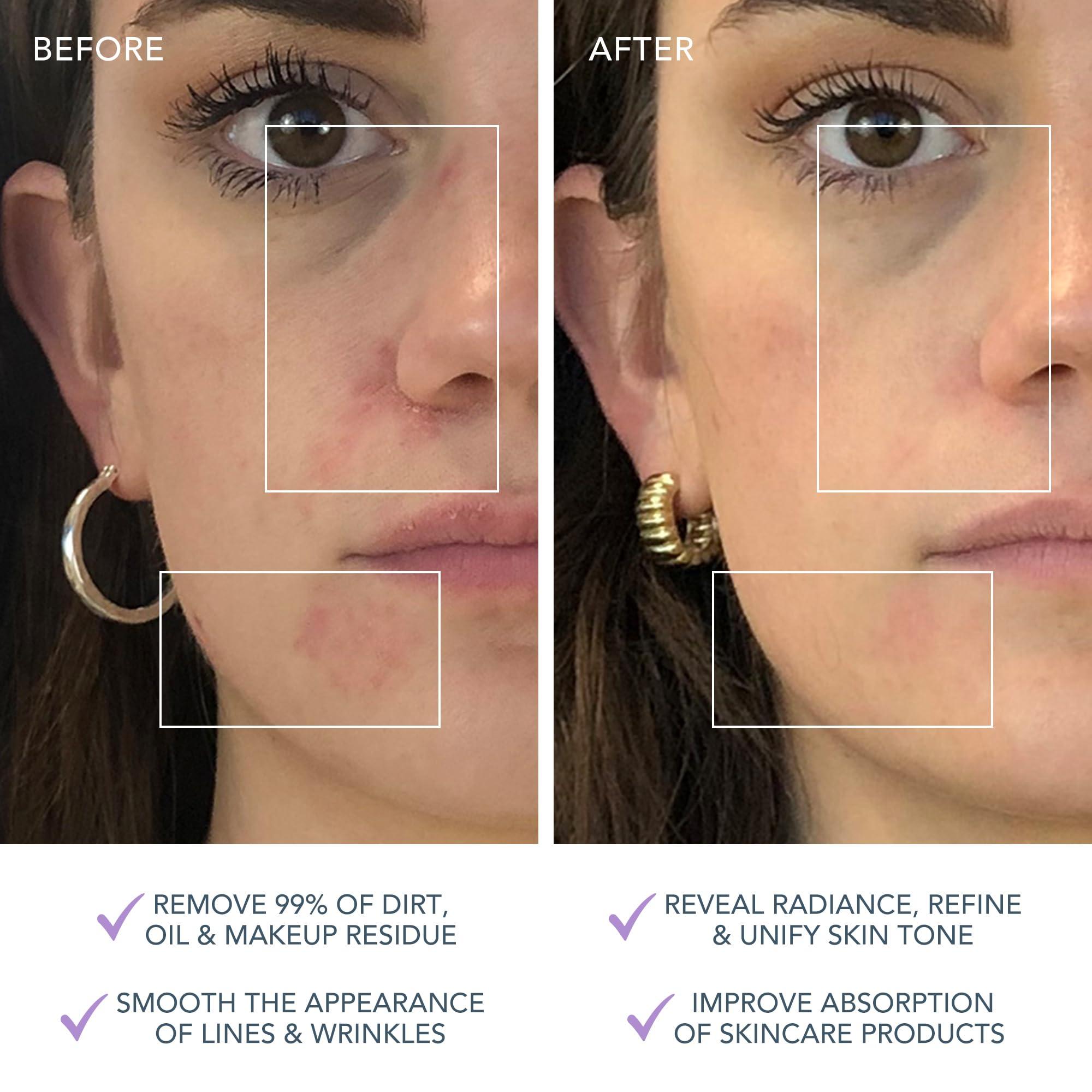 FOREO FOREO LUNA 3 Facial Cleansing Brush | Sensitive Skin | Anti Aging Face Massager | Enhances Absorption of Facial Products | For Clean & Healthy Face Care | Simple & Easy | Waterproof