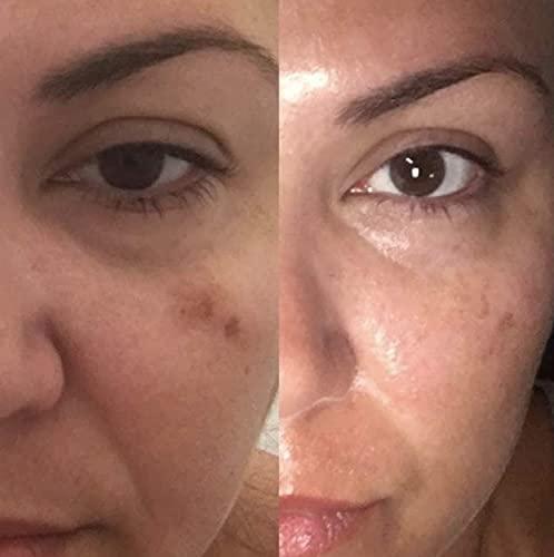 Divine Derriere Save 18% on The Skin Care Solution For Dark Spots, Razor Bumps, Ingrown Hair & Razor Burns – Includes Our Ultra Potent Brightening + Razor Bumps Pads For an Ultra Clear & Glowing Skin