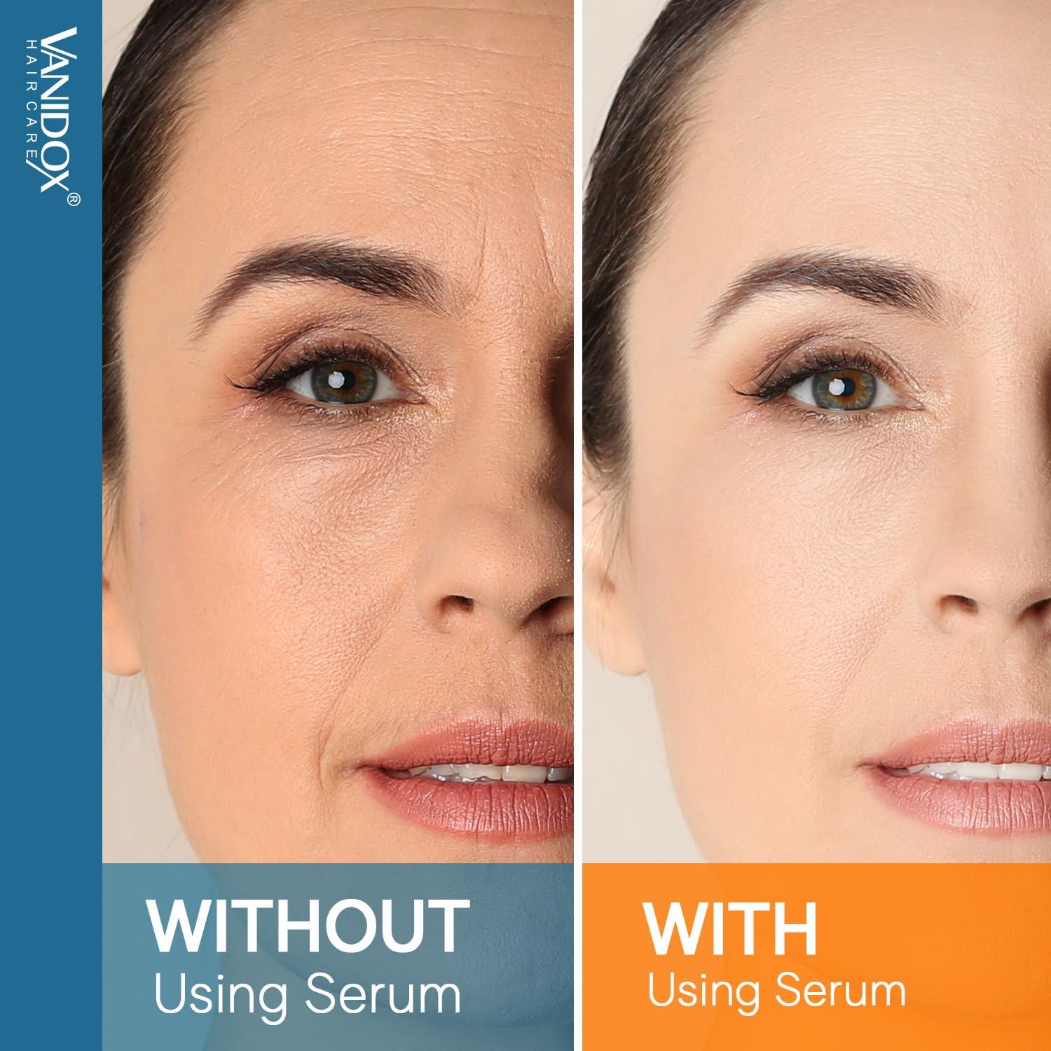 VANIDOX VANIDOX Super C Serum for Women Over 70, All-In-One Formula, Made in USA, Hydrates, Firms, Lifts, and Targets Wrinkles, Age Spots, and Fine Lines, Vitamin C Serum (1fl oz x 2)