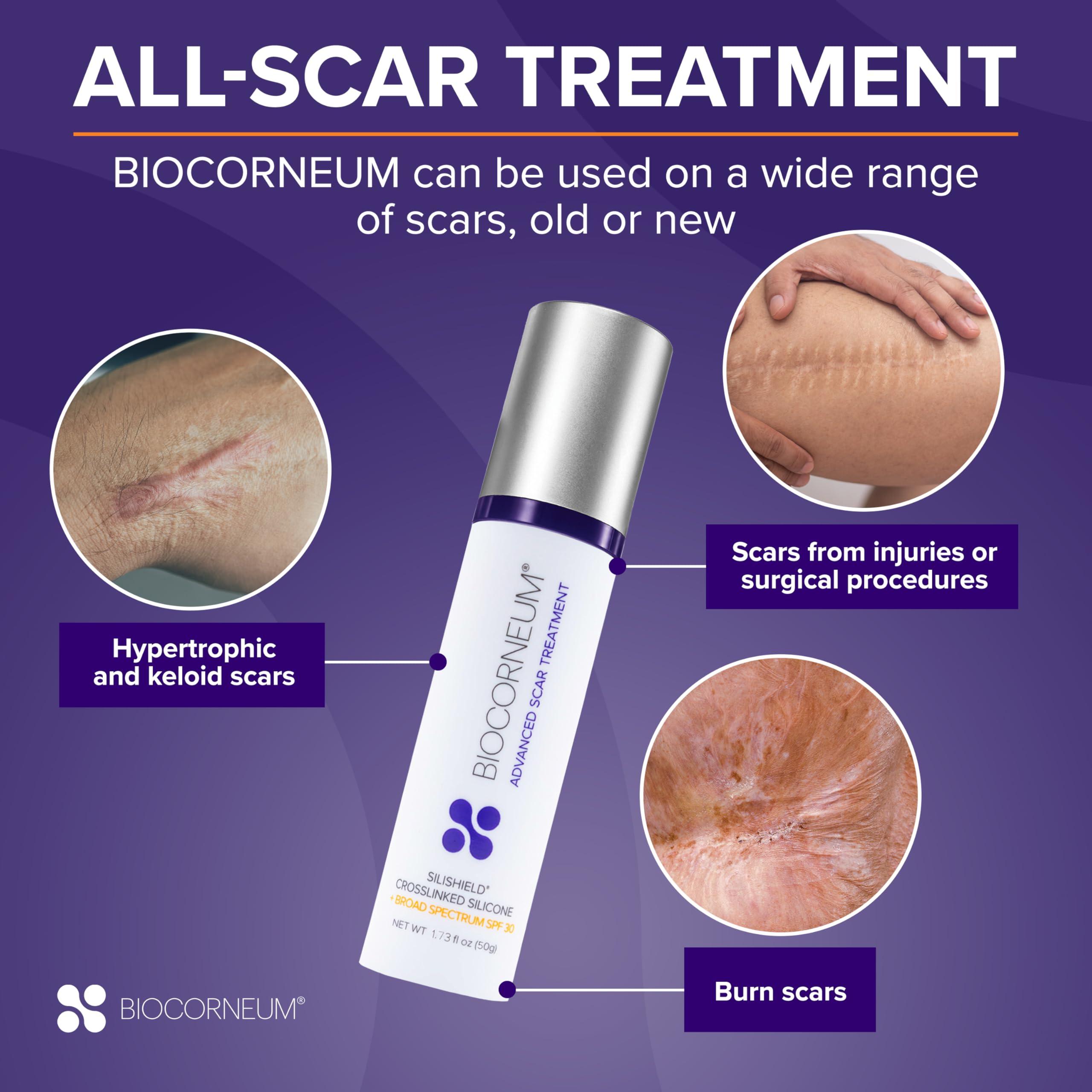 bioCorneum Advanced Scar Treatment with Silishield & SPF 30 20g Made in the USA, Fast-Drying, Water-Resistant Silicone Scar Gel - Surgeon Recommended for New & Old Scars - Suitable for Children Over 6 Months