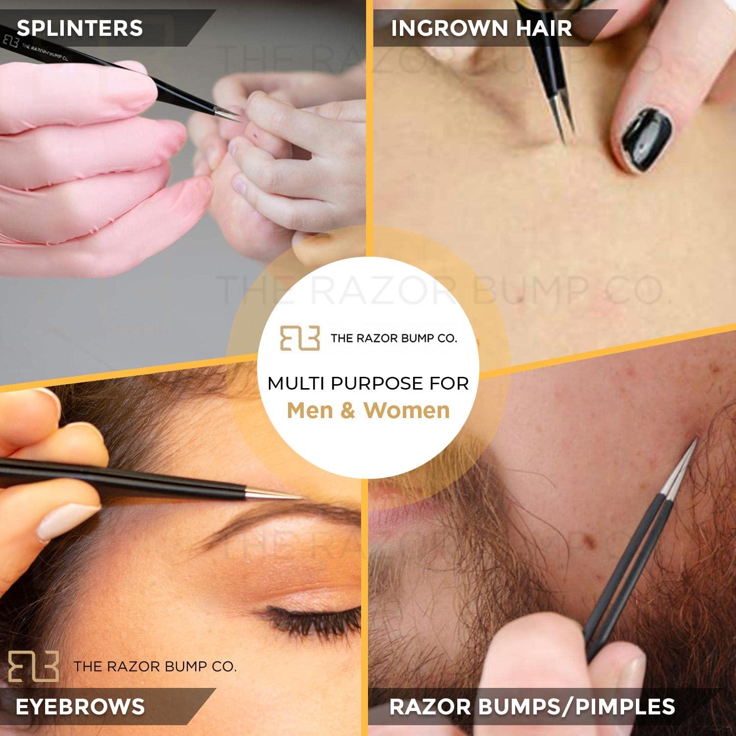 TRBC Tweezers For Ingrown Hair By The Razor Bump Co. | Sharp, Stainless Steel, Surgical | Professional Tweezers For Women and Men | Precision Splinter Remover | Best Facial Hair and Eyebrow Trimmer | Black