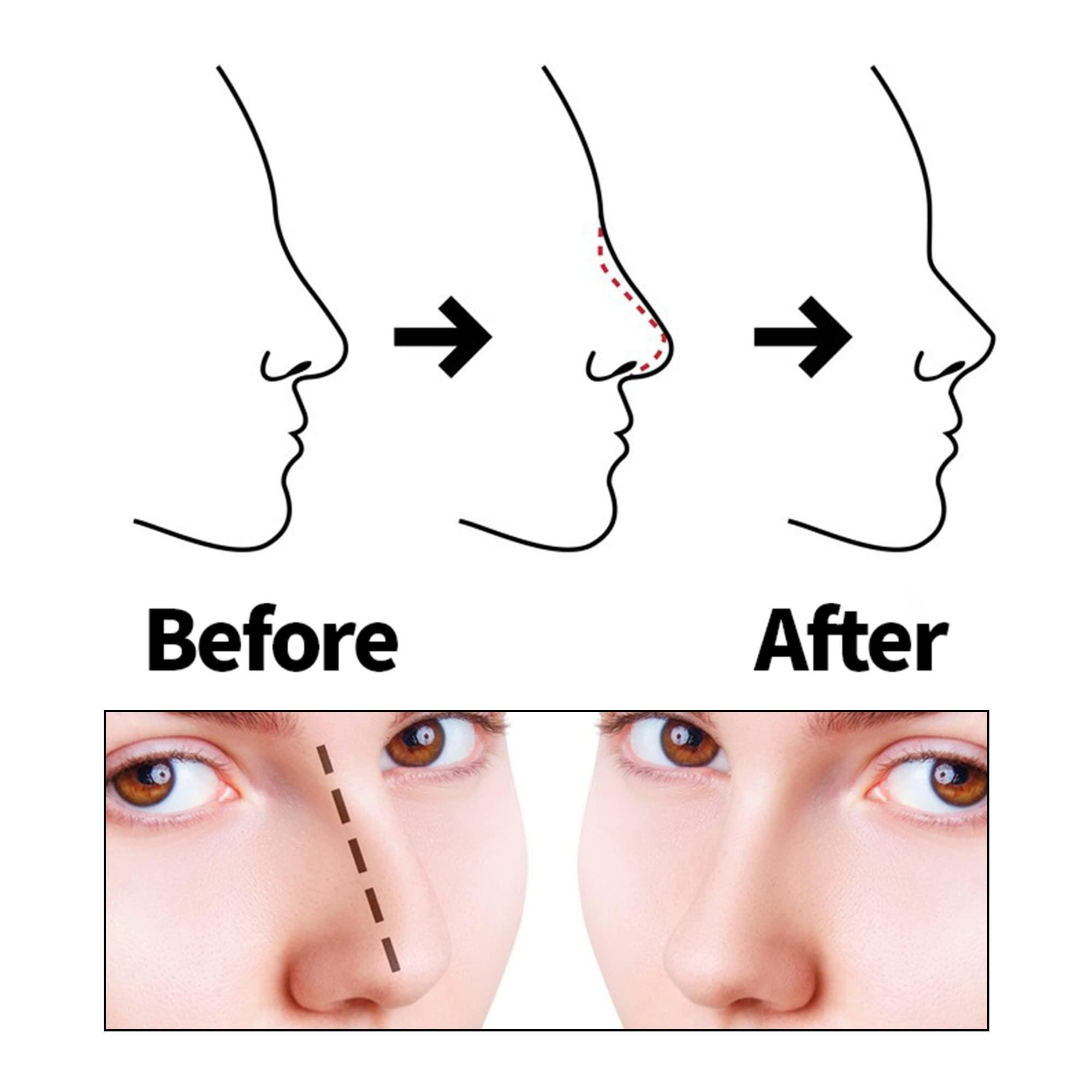 HYPOD HYPOD Pdo Cog Threads, Nose Thread Pdo Lifting Thread 16 PCS, 19G60MM