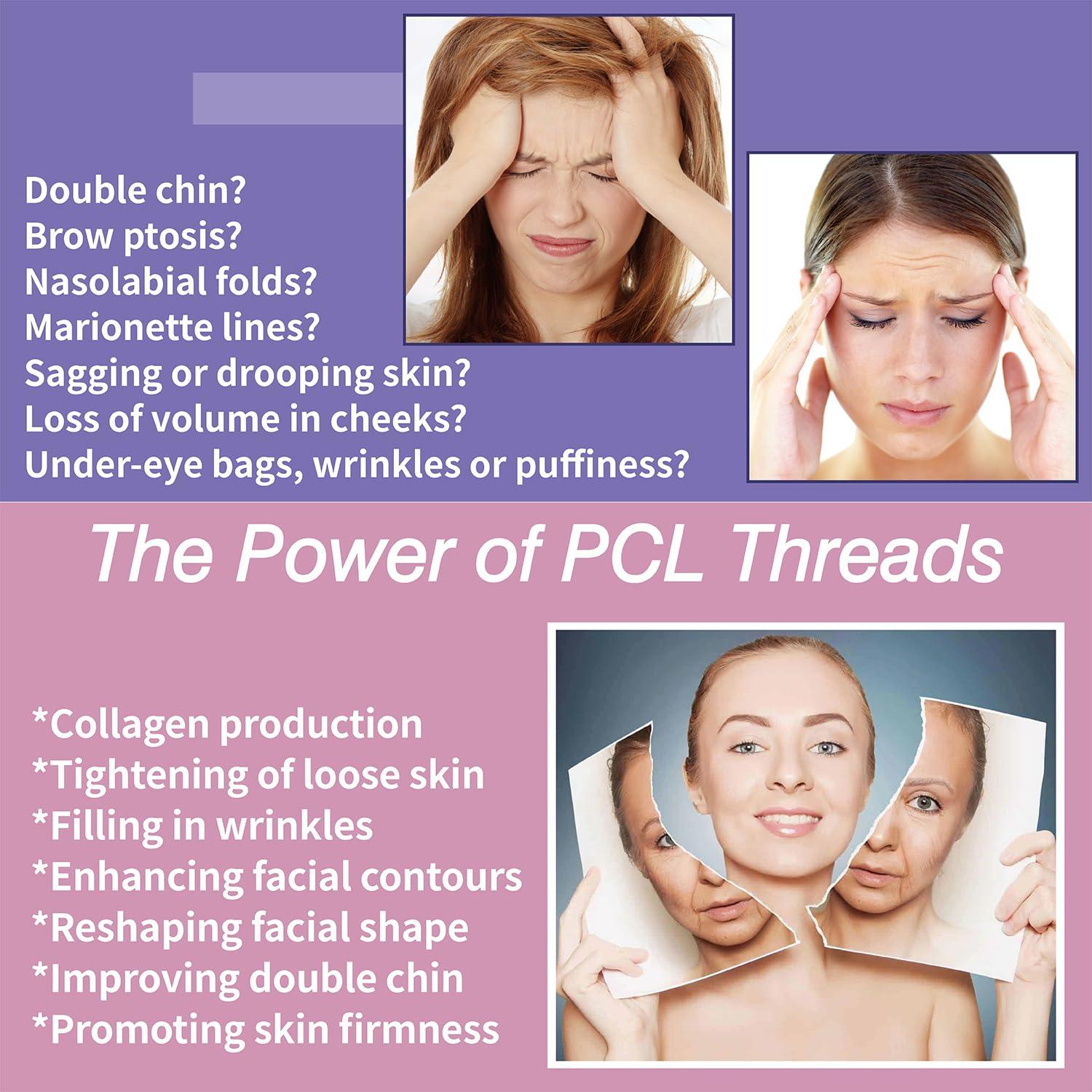 elves Elves PCL Threads for Face Pcl Screw Thread Lift 30G13mm Mono Screw Type Face Lifting 20Pcs Facial Thread Smoothing Wrinkles with Sharp Tip