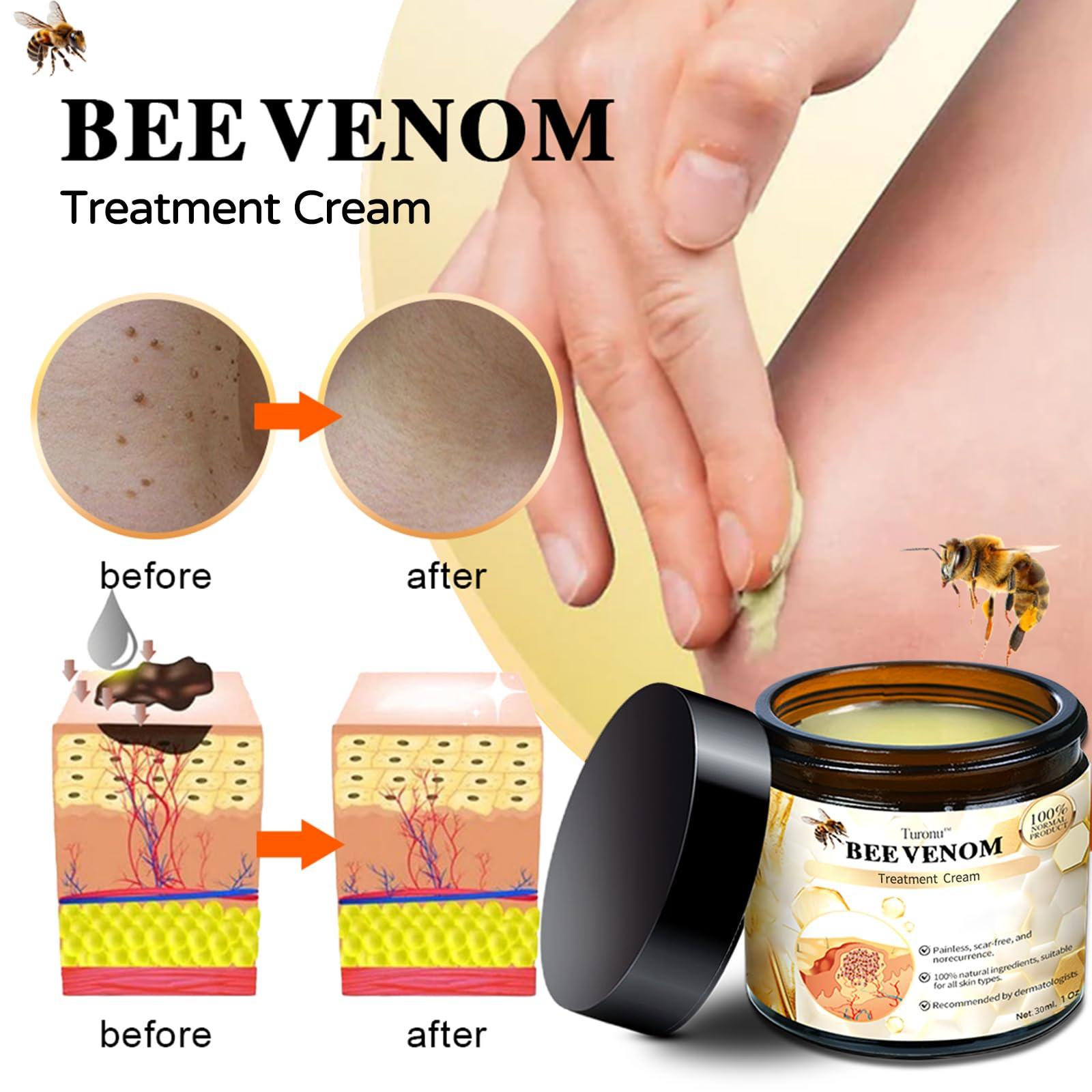 bostore Bee Venom Treatment Cream - Bee Venom Repair Cream, Professional Bee Venom Correcting Gel for All Skin Types (4Bottle)