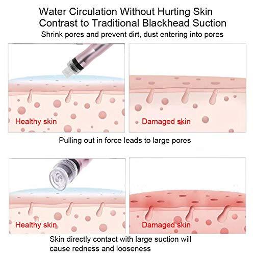 Zerone- Facial Suction Machine, Facial Cleaning Machine Small Bubbles Vacuum Suction Beauty Equipment for Home or SPA Salon (1#)