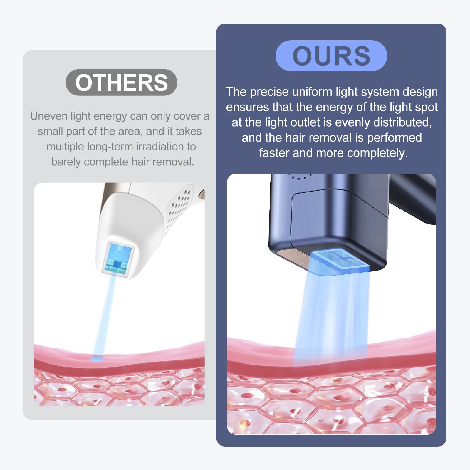 ViQure Viqure IPL T8 Laser Hair Removal for Women and Men, Fast and Long-lasting Painless Hair Removal Device with Cooling System, 990000 Flash, LED, Multifunction Double Head, For Body & Face at-Home Use