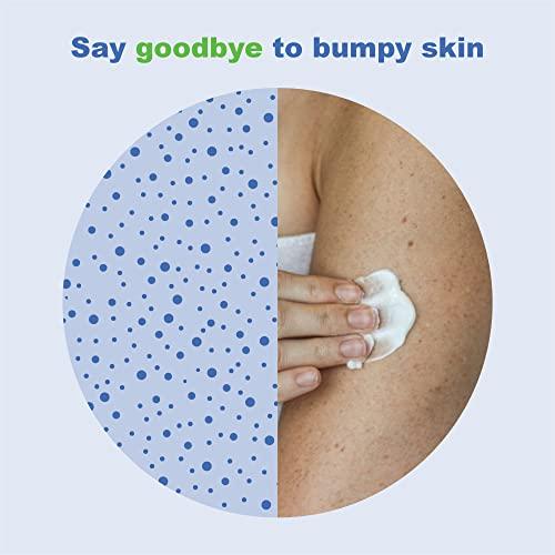 KP Elements KP Elements Keratosis Pilaris Lotion (4 fl oz) - Natural Keratosis Pilaris Treatment, Moisturizing & Exfoliating AHA Lotion for KP, Vegan, Made in USA