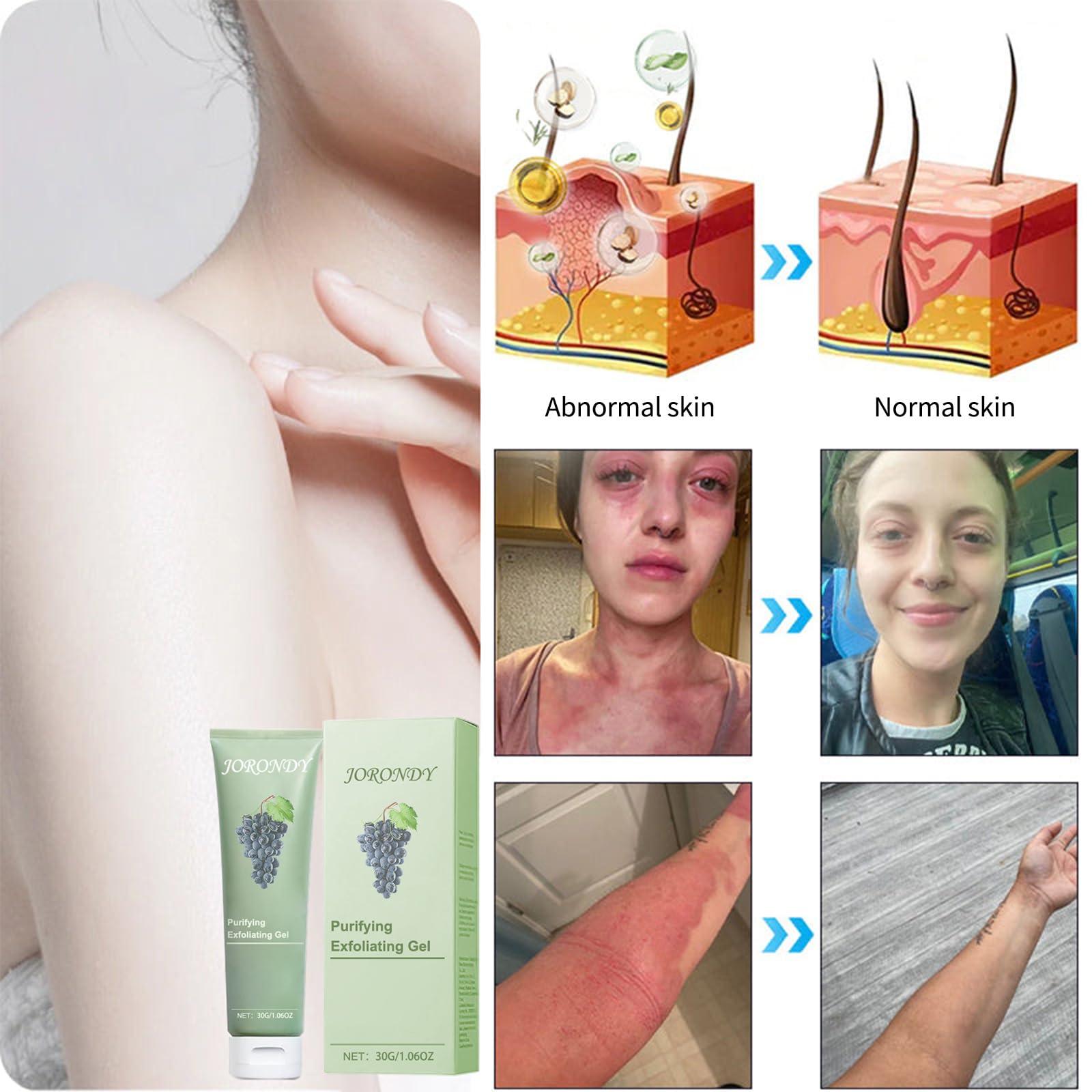 Luhaka JORONDY Purifying Peel Gel, purifying peel, deep cleans and moisturizes the skin, effective exfoliation