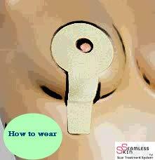 Seamless Skin SEAMLESS SKIN Scar Removal Treatment System (Set of 2) Silicone Gel Sheets - Mastopexy Areopexy Recovery - Breast Anchor Lift For Post Op Surgery & Stretch Marks Reducer