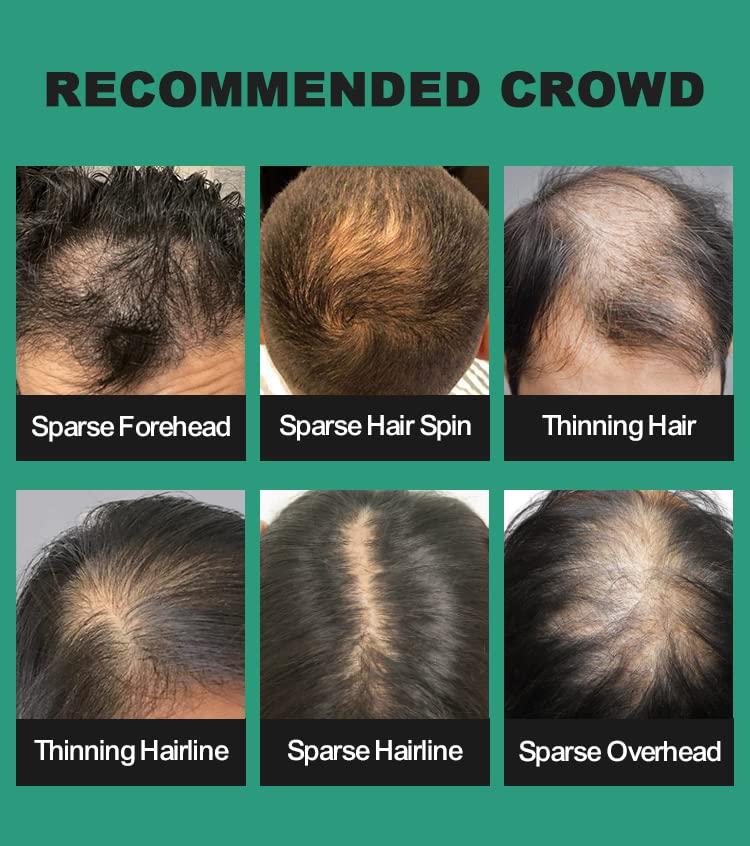 UOYOU BLACK Hair Fibers for Thinning Hair 27.5g Bottle with Applicator | Undetectable & Natural Keratin Hair Fibers Concealer for Hair Loss for Men and Women | Hair Building Fibres Powder [BLACK Hair Fiber]