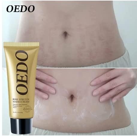 OEDO OEDO Rose Remove Stretch Mark Cream Nourish Anti-wrinkle Pregnant Women Skin Repair Remove Obesity Tattoo Body Care 40g