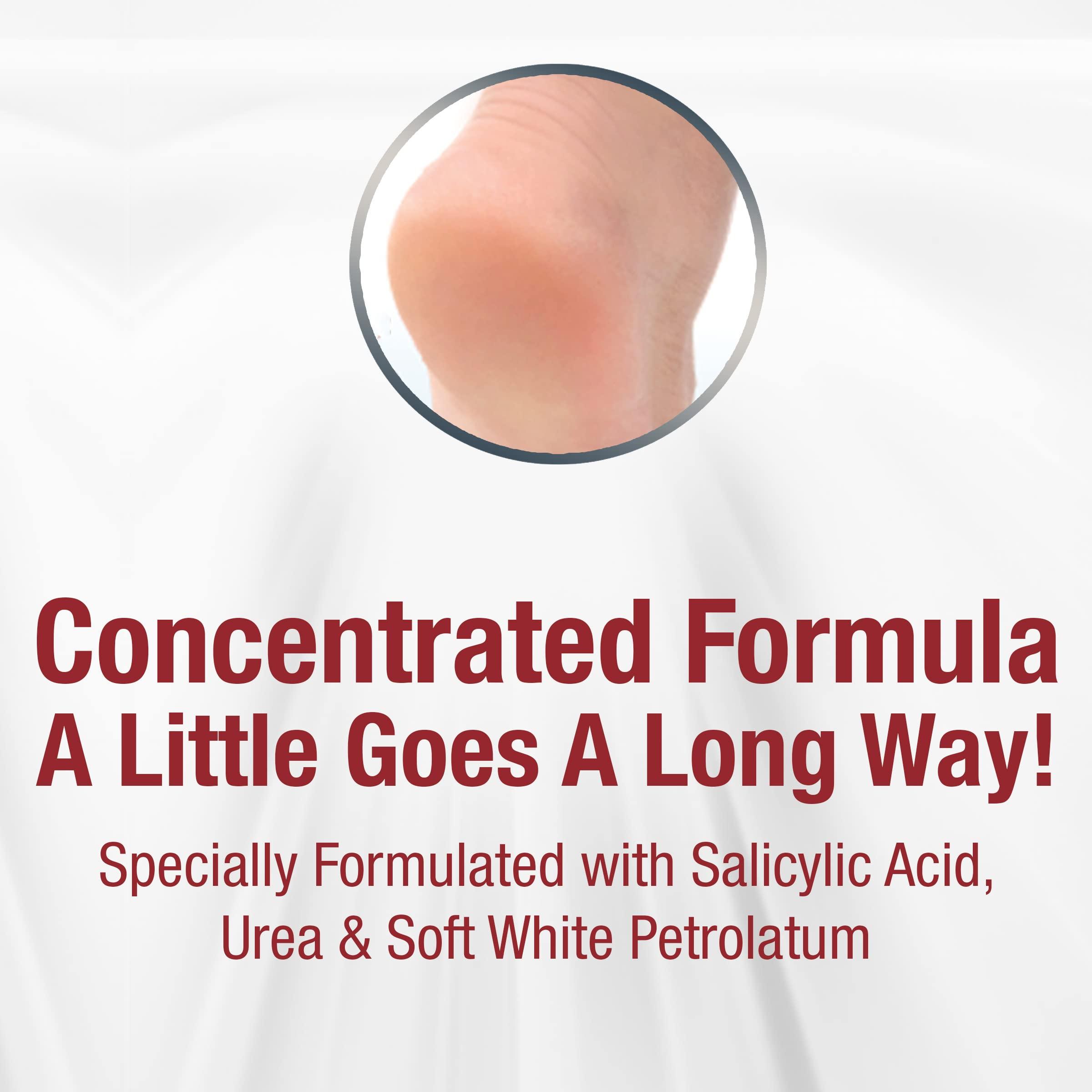 Kerasal Kerasal Intensive Foot Repair Skin Healing Ointment for Cracked Heels and Dry Feet 1 oz , 2 Count, (Pack of 2)