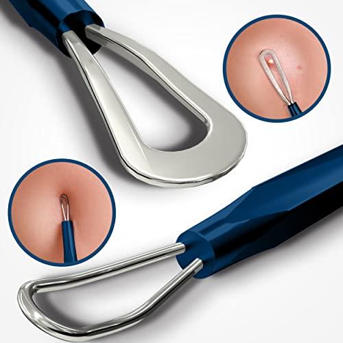 Utopia Care Utopia Care - Professional Blackhead and Blemish Remover - Pimple Comedone Removal 2-in-1 Extractor Tool - Spectrum Blue