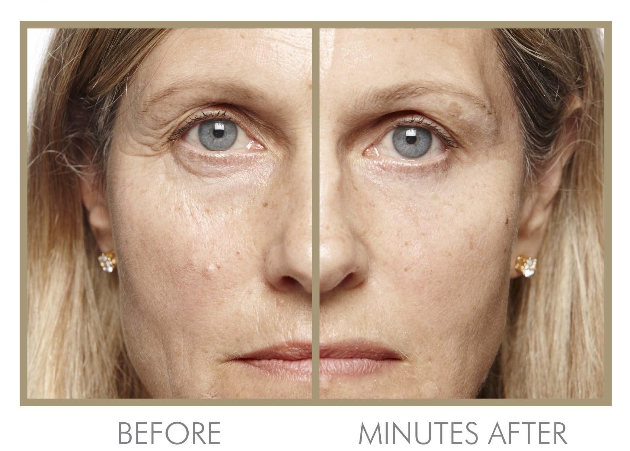 GENIE Beauty Products GENIE Instant Line Smoother (30 ml/1 fl oz)