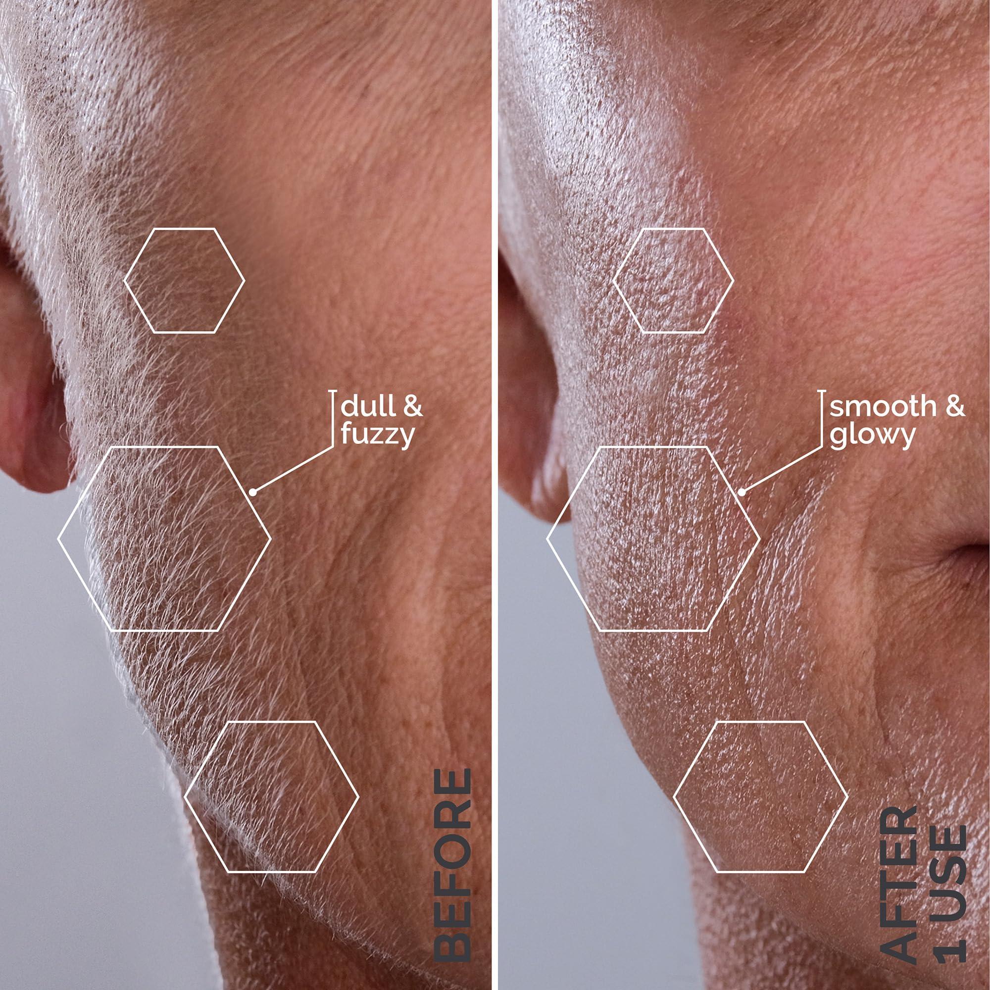 MICHAEL TODD BEAUTY Michael Todd Beauty - Sonicsmooth  SONIC Technology Dermaplaning Tool - 2 in 1 Womens Facial Exfoliation & Peach Fuzz Hair Removal System with 8 Weeks of Dermaplaning Blades