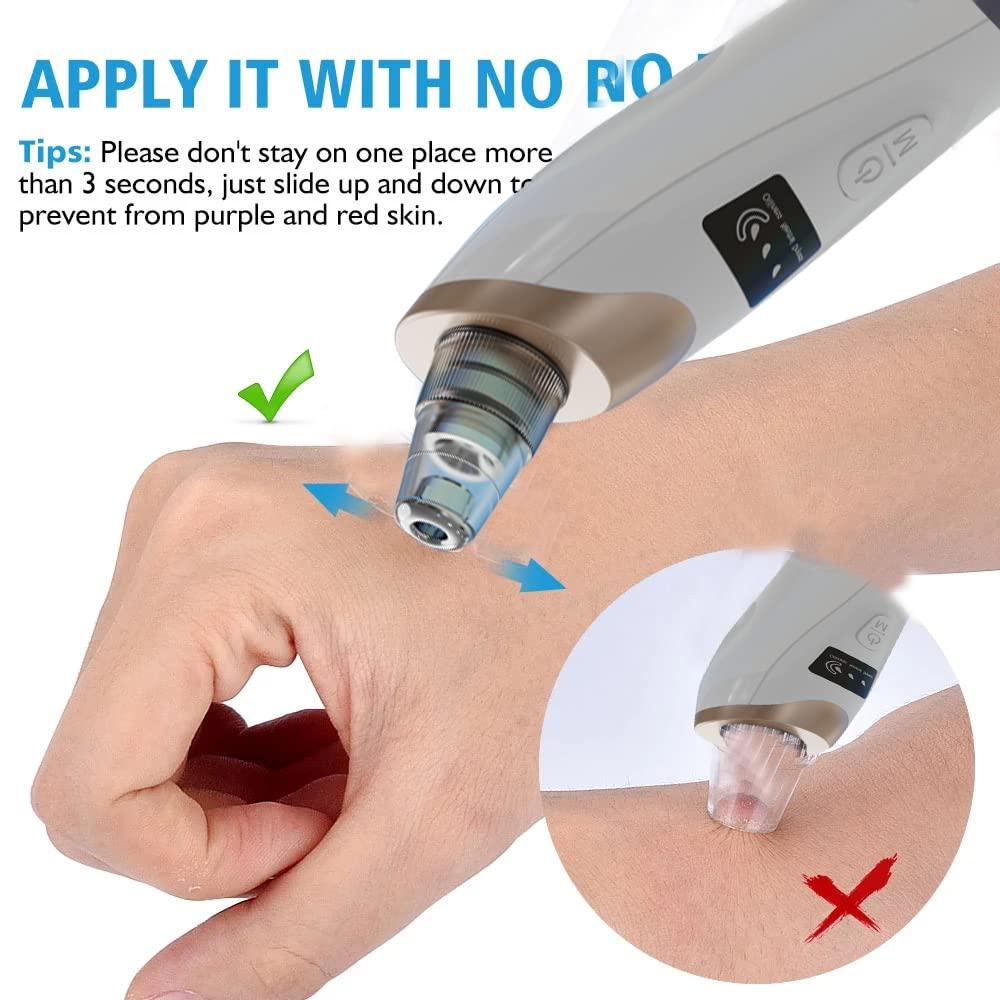 Suction blackhead beauty face Suction blackhead instrument electric pore cleaning export beauty instrument home to get rid of acne cleanser