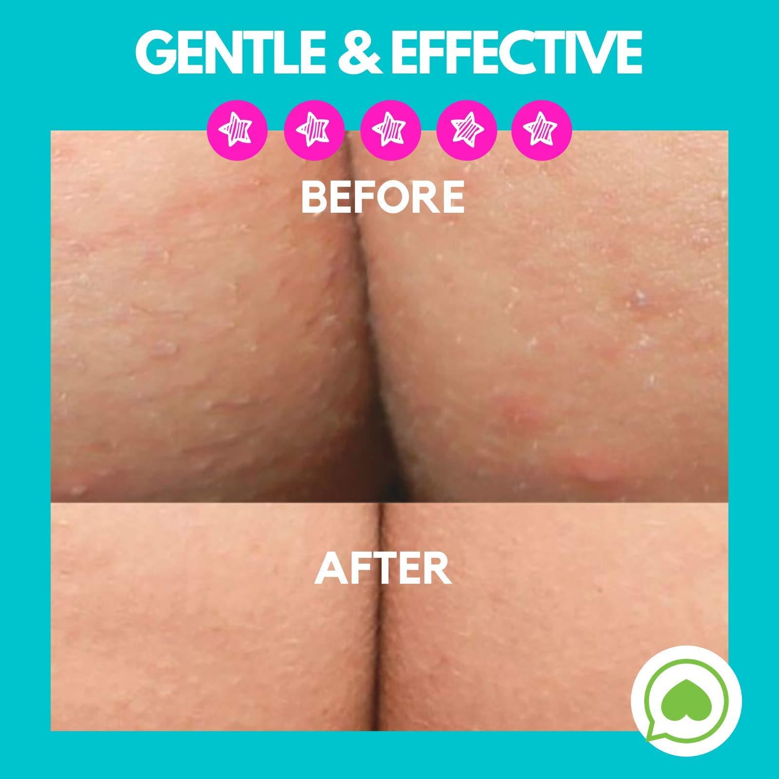 Green Heart Labs Brilliant Booty Kit | Butt Acne Clearing Lotion and ExfoliMATE Magic Body Exfoliating Cloth for Soft & Young Skin (Black)