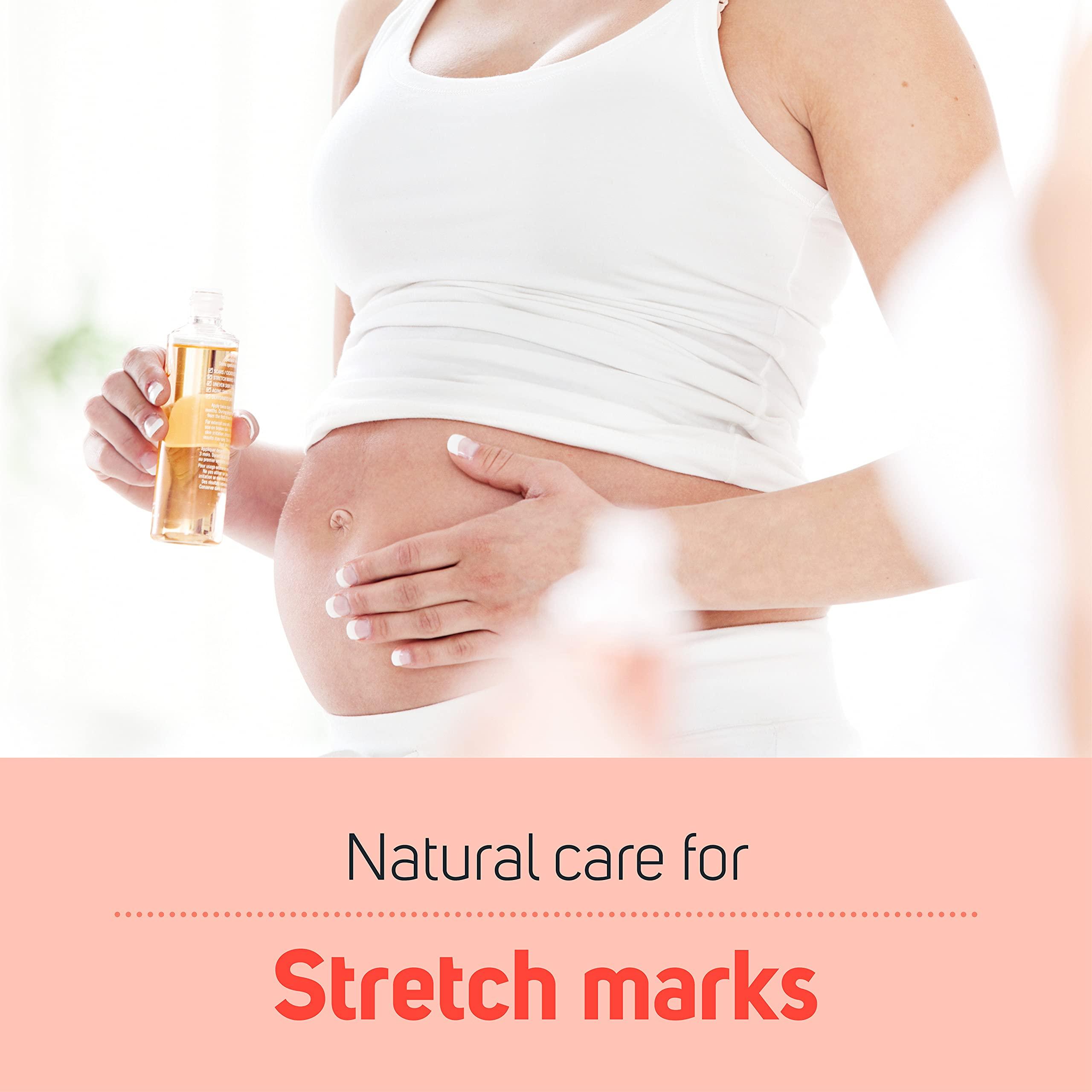Care Science Care Science Stretch Marks + Scars Skin Care Body Oil, 5 OZ | For C Section Recovery, Scars, Stretch Marks, Hair, Aging, Dehydrated Skin | Natural Ingredients, Vitamin E Oil, Olive Oil, Coconut Oil