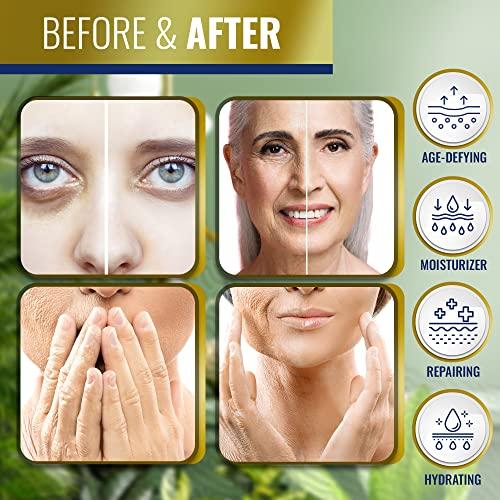 Advanced Clinicals Advanced Clinicals Retinol Body Lotion Moisturizer Face Lotion & Body Cream | Crepey Skin Care Treatment Targets Look Of Crepe Skin, Wrinkles, Sagging Skin, & Sun Damaged Skin, 16 Oz