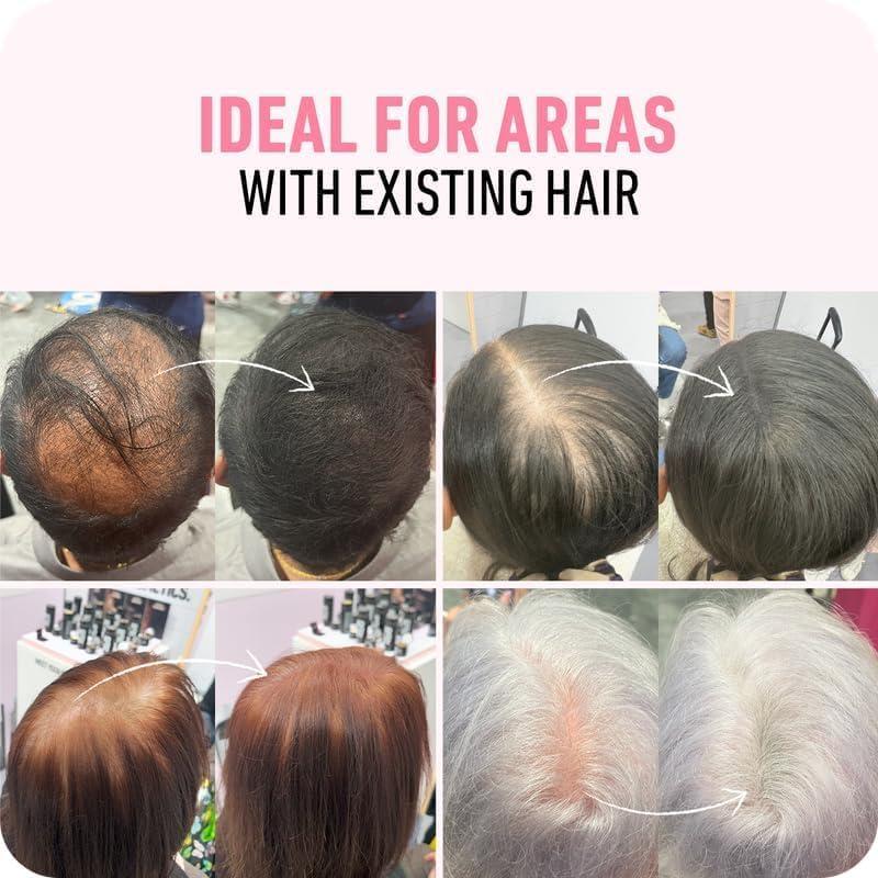 Boldify BOLDIFY Hair Fibers (2 x 56g) - Fill In Thinning and Fine Hair for an Instantly Fuller, Thicker Look - 14 Shades for Women & Men - Dark Brown