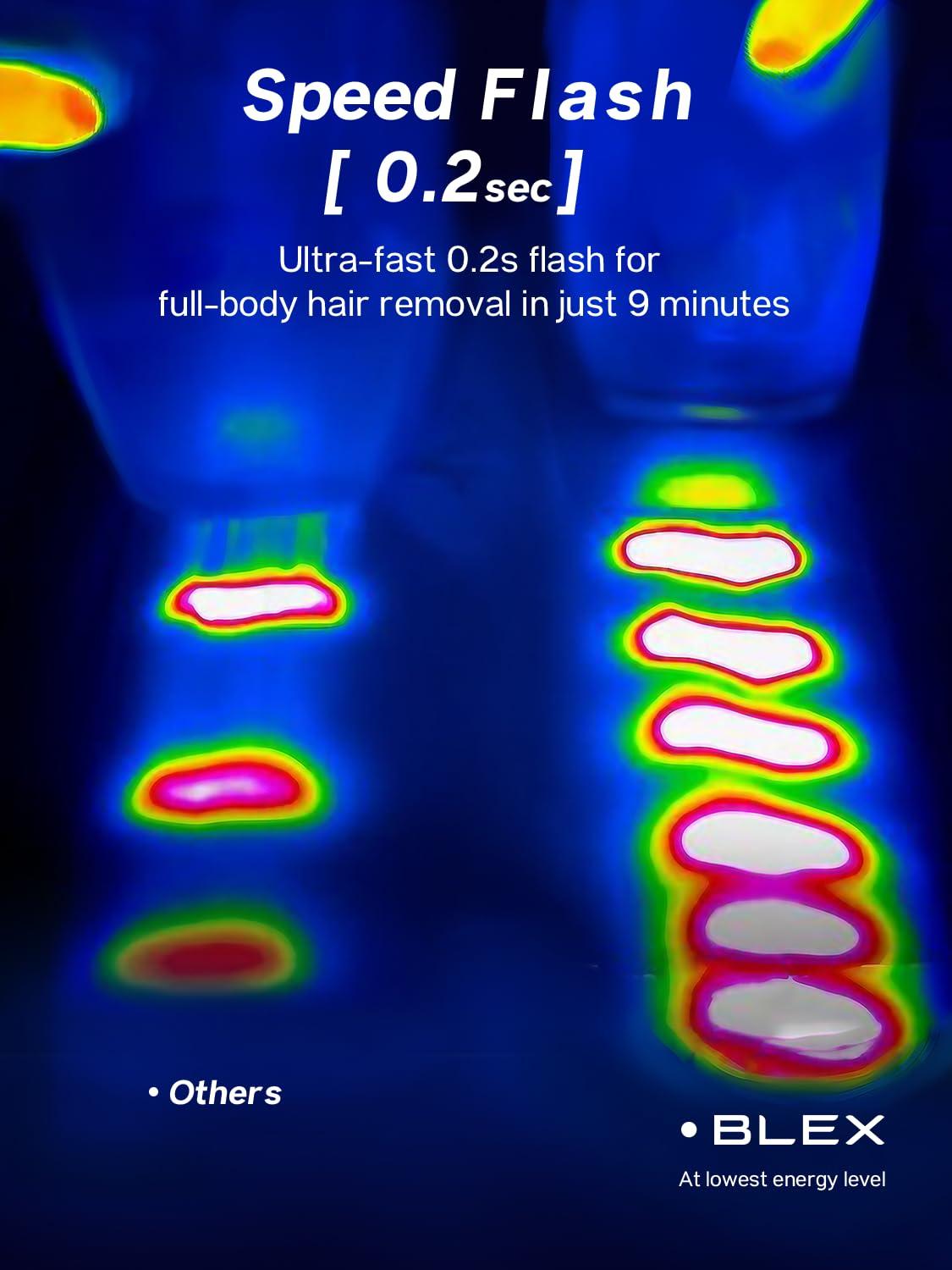 Blex Blex Laser Hair Removal for Women and Men, IPL Hair Removal Device Effective in 2 Weeks, with Ultra-Fast 0.2s Light Emission, Comfortable and Painless