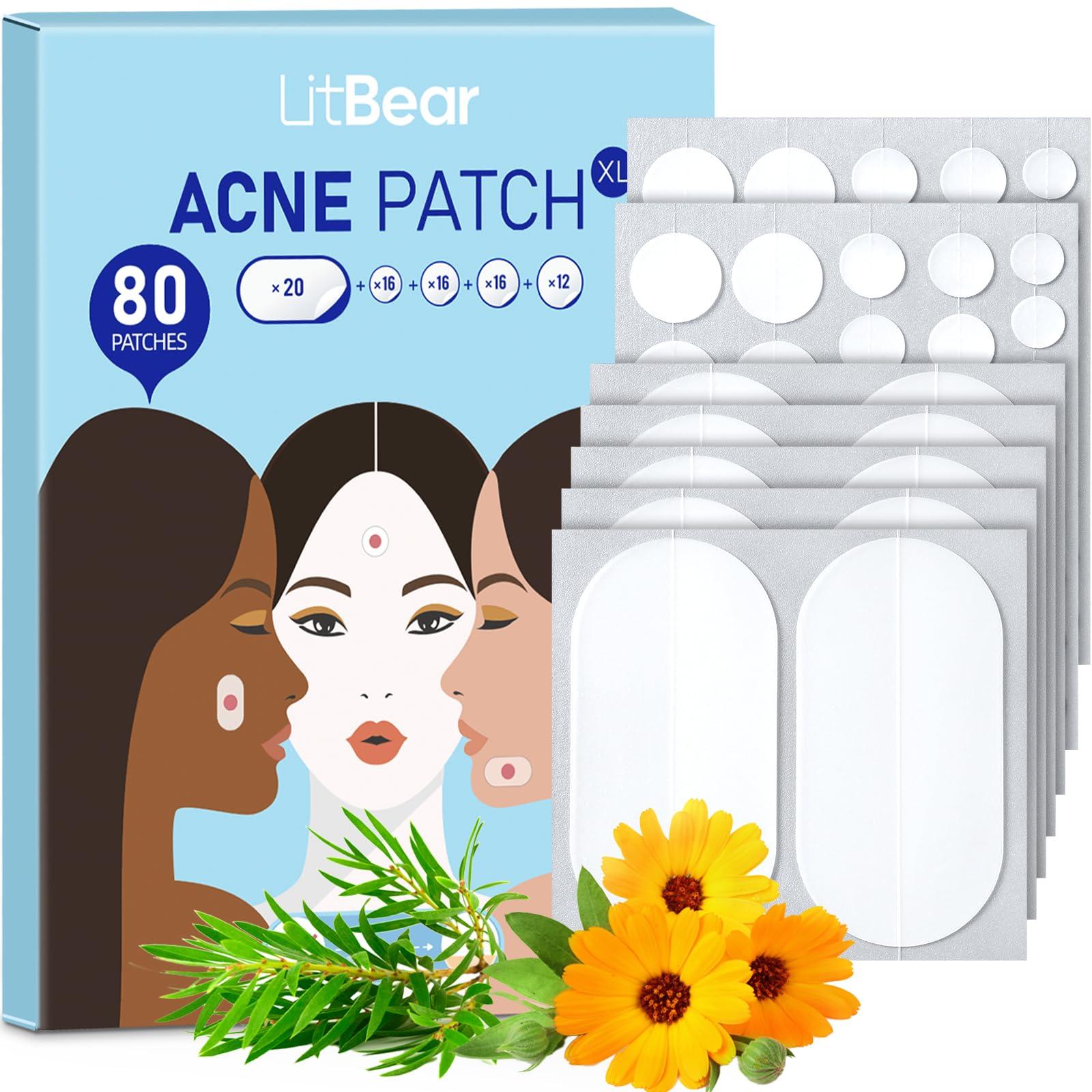 LitBear LitBear Large Acne Pimple Patches 5 Sizes 80 Patches and Acne Patch Bulk 480 Patches 3 Size