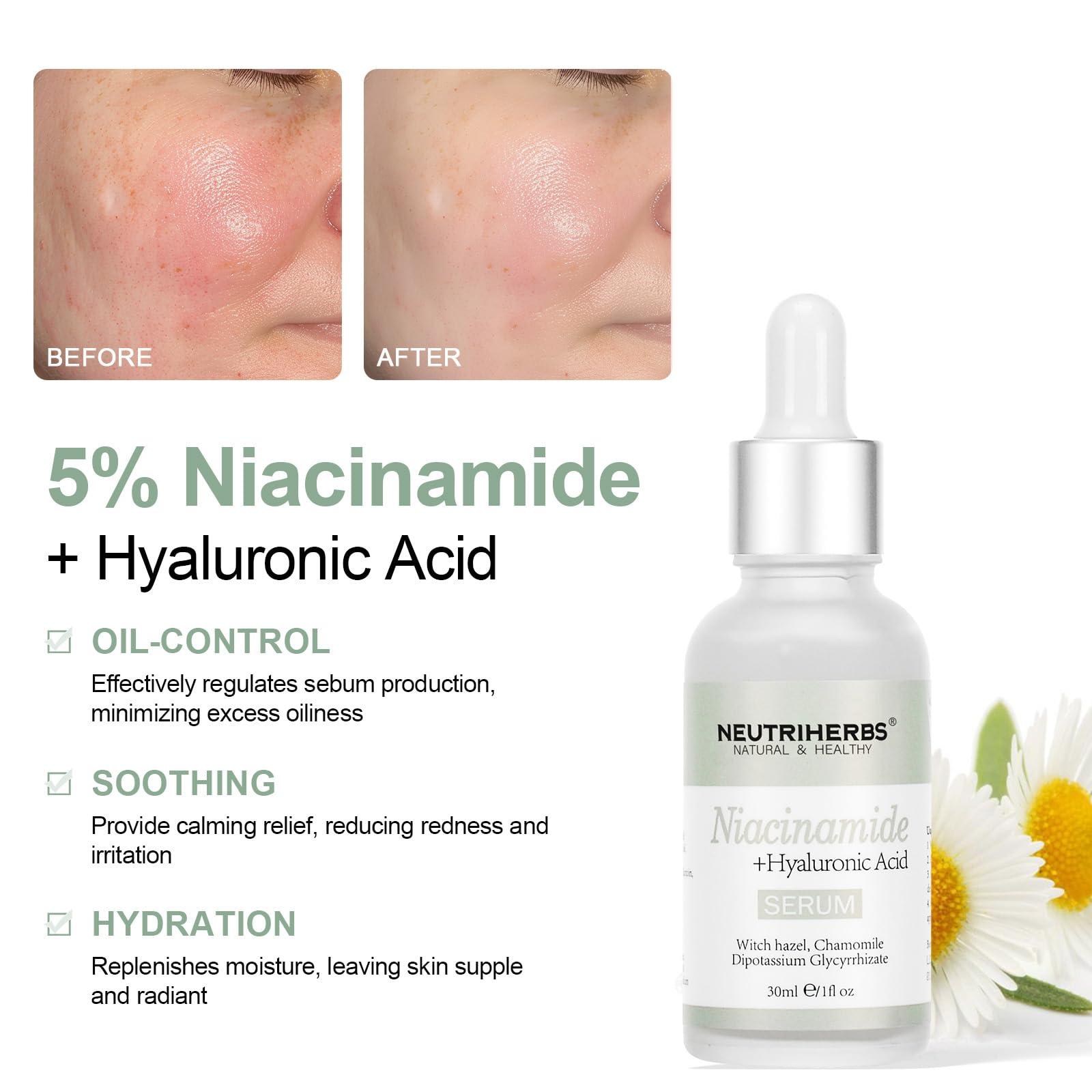 Neutriherbs Neutriherbs 4% Niacinamide Serum for Face the Ordinary + HA,Effectively Work to Control Excess Facial Oil, Minimize the Pores and Prevent Breakouts, Best Niacinamide Serum For Oily Skin