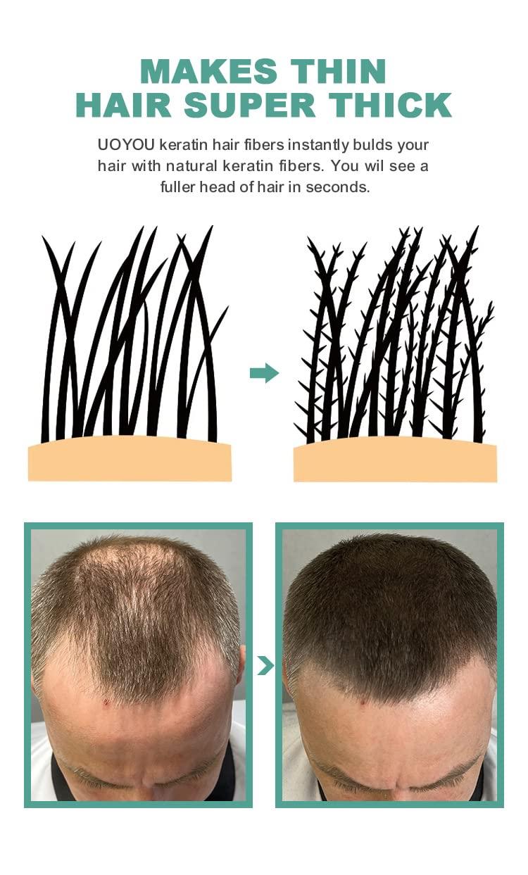 UOYOU GREY Hair Fibers for Thinning Hair 27.5g Bottle | Undetectable & Natural Keratin Hair Fibers Concealer for Hair Loss for Men and Women | Hair Building Fibres Powder [GREY]