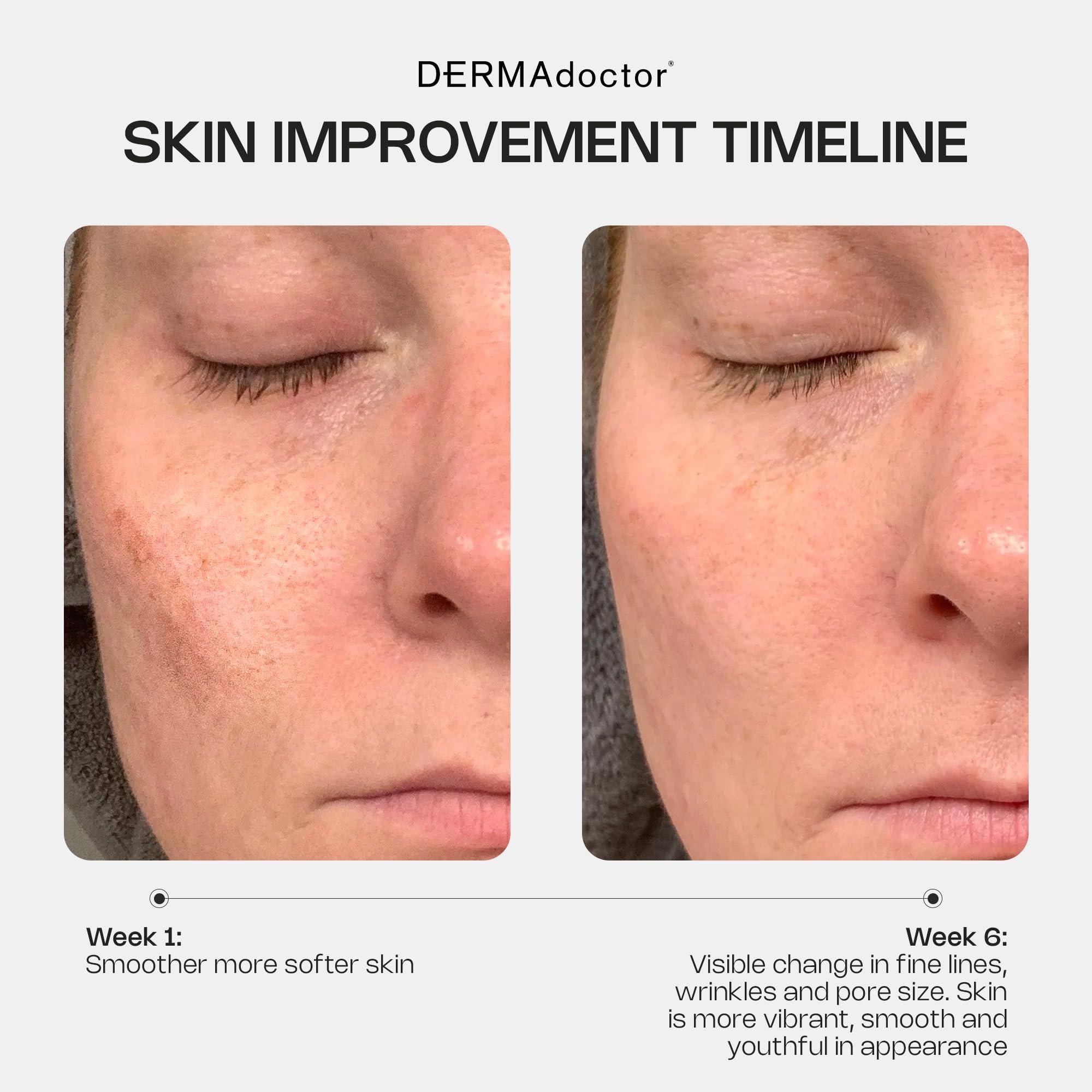 DERMAdoctor DERMAdoctor Kakadu C Dermatologist Formulated 1% Retinol Cream + Vitamin C, E Ferulic Complex, Anti Aging Face Cream to Brighten, Smooth and Firm. Hyperpigmentation Treatment for Face - 1.01 fl oz