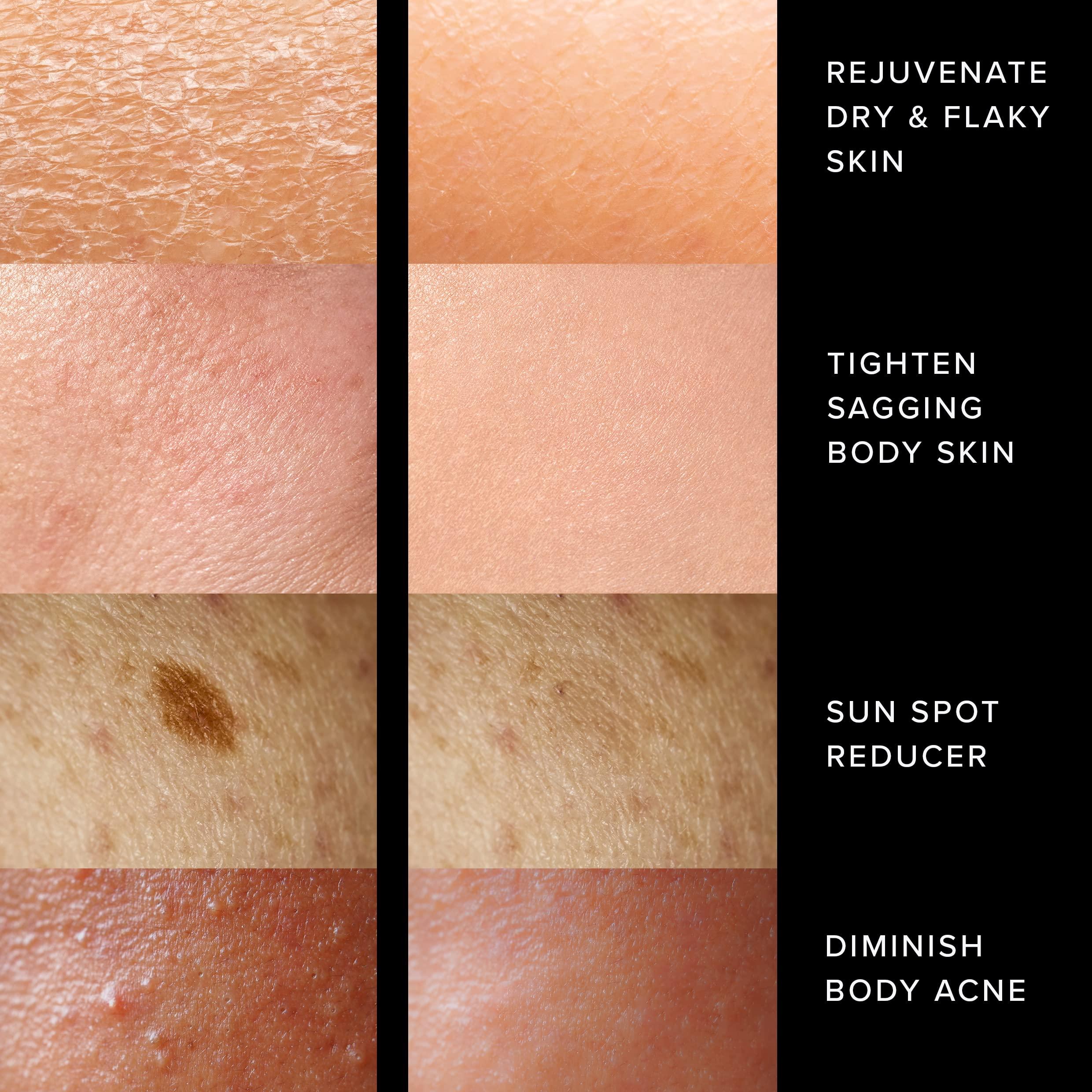 Adonia Organics Adonia StemuTone - Firm, Lift & Tighten Body – Reduce stretch marks, scars, dryness & sagging skin – Reduce the appearance of age spots – Leaves skin feeling SUPER SOFT