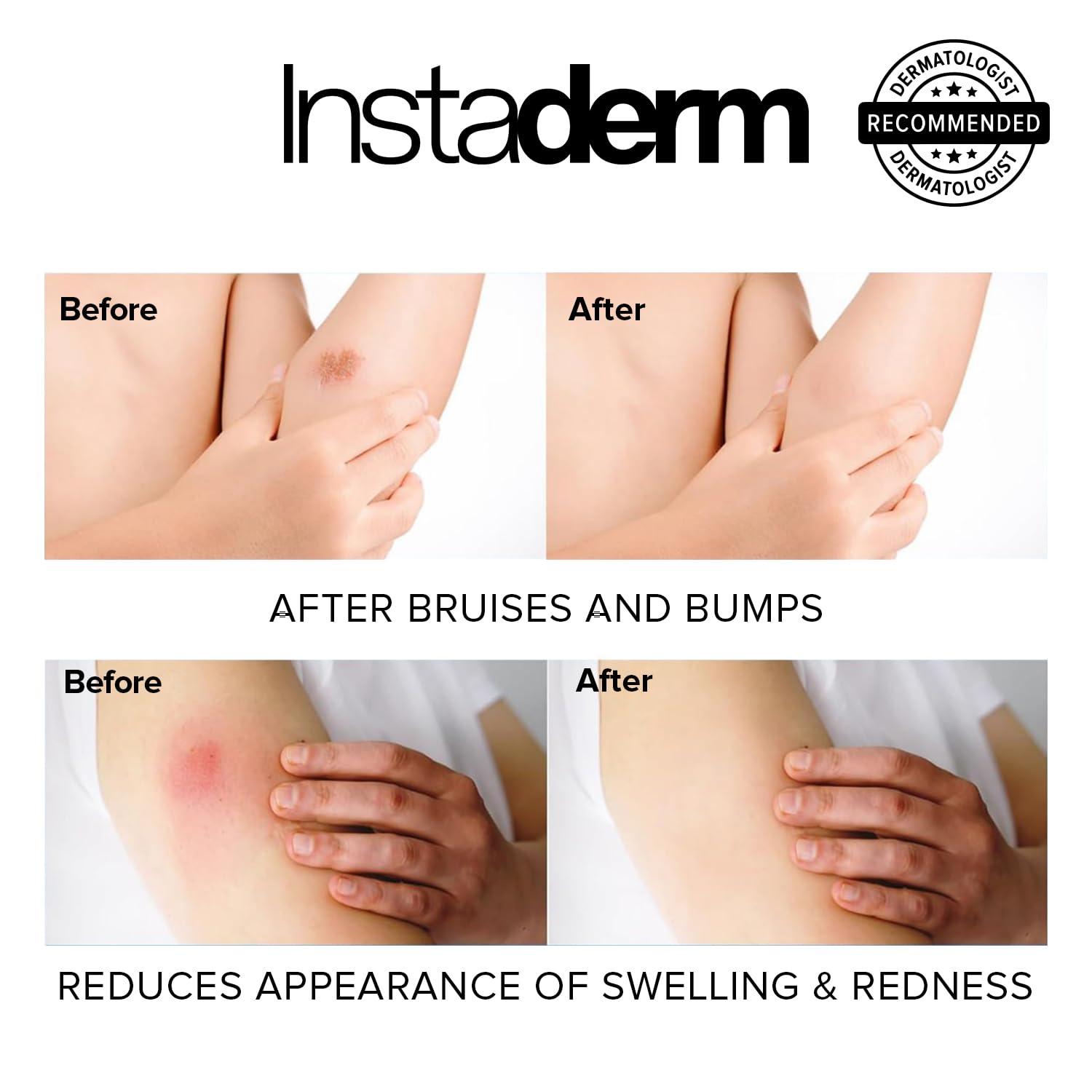 Instaderm Instaderm Vitamin K Cream- Bruise Healing Formula with Arnica. Dark Spot Moisturizer for Bruising, Spider Veins & Broken Capillaries. Repair Under Eye Dark Circles, & Puffiness.