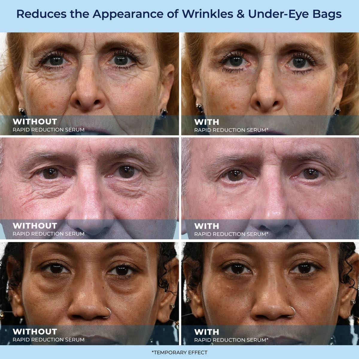 NinthAvenue Basics Plexa derm Rapid Reduction Wrinkle Serum - Reduces Under-Eye Bags, Wrinkles, Dark Circles, Fine Lines & Crow's Feet Instantly (2-Pack)