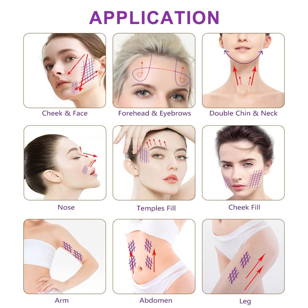 elves Elves 4D COG PDO Threads for Face Whole Body Lift B19G-100 / PDO Cog Threads Bidirectional Blunt-Type for Face Lift/10pcs