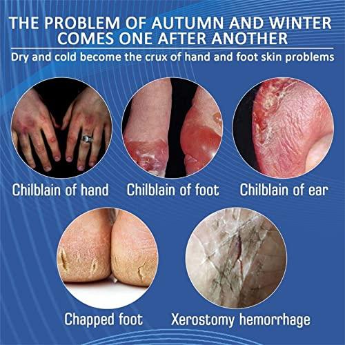 DRXVE DRXVE Chilblain Cream, Anti-cracking Frostbite Moisturiser Deep Nourishing, Anti Crack & Hand Foot Cream, Foot Repair Cream, for Dry Cracked Heels Callus Remover (2 Pc)