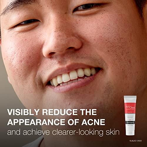 Neutrogena Neutrogena Rapid Clear Stubborn Acne Spot Treatment Gel with Maximum Strength 10% Benzoyl Peroxide Acne Treatment Medication, Pimple Cream for Acne Prone Skin Care, 1 oz