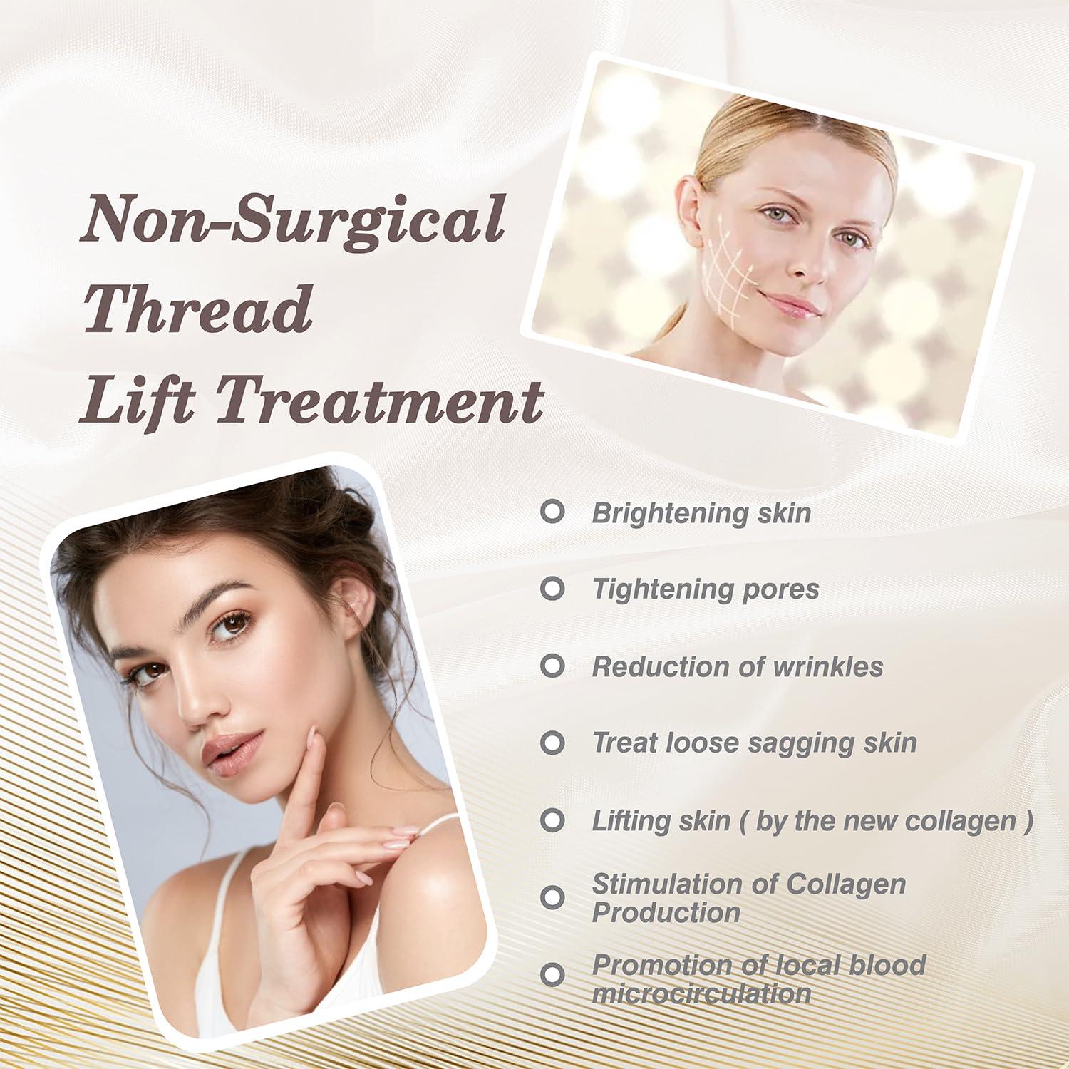 Newliky Pdo Threads for Face Lift Mono Screw Type (29G50MM) Smoothing Wrinkles PDO Thread Lift for Whole Body with Sharp Tip 20pcs